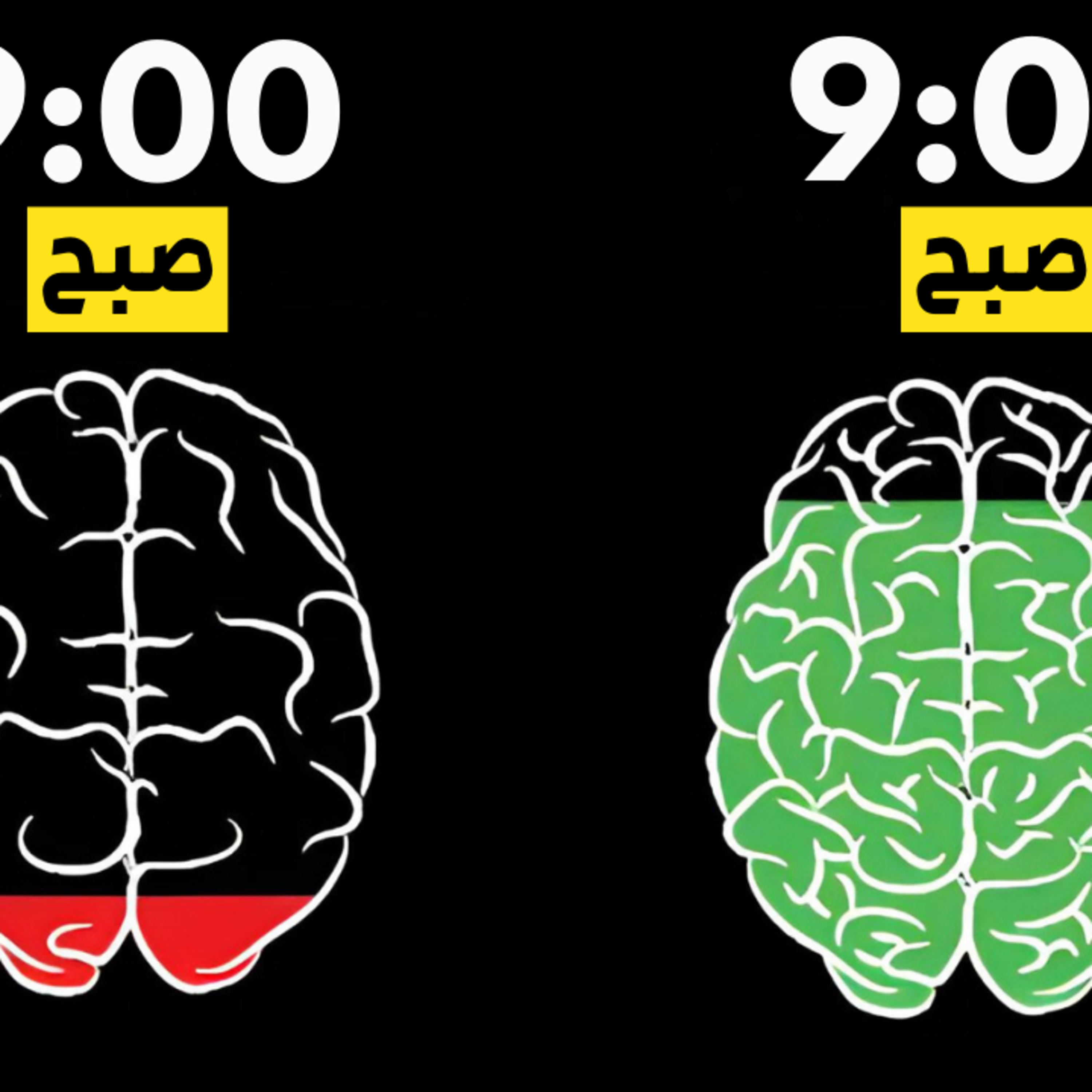 پوسیدگی مغزم رو اینجوری درست کردم! episode artwork
