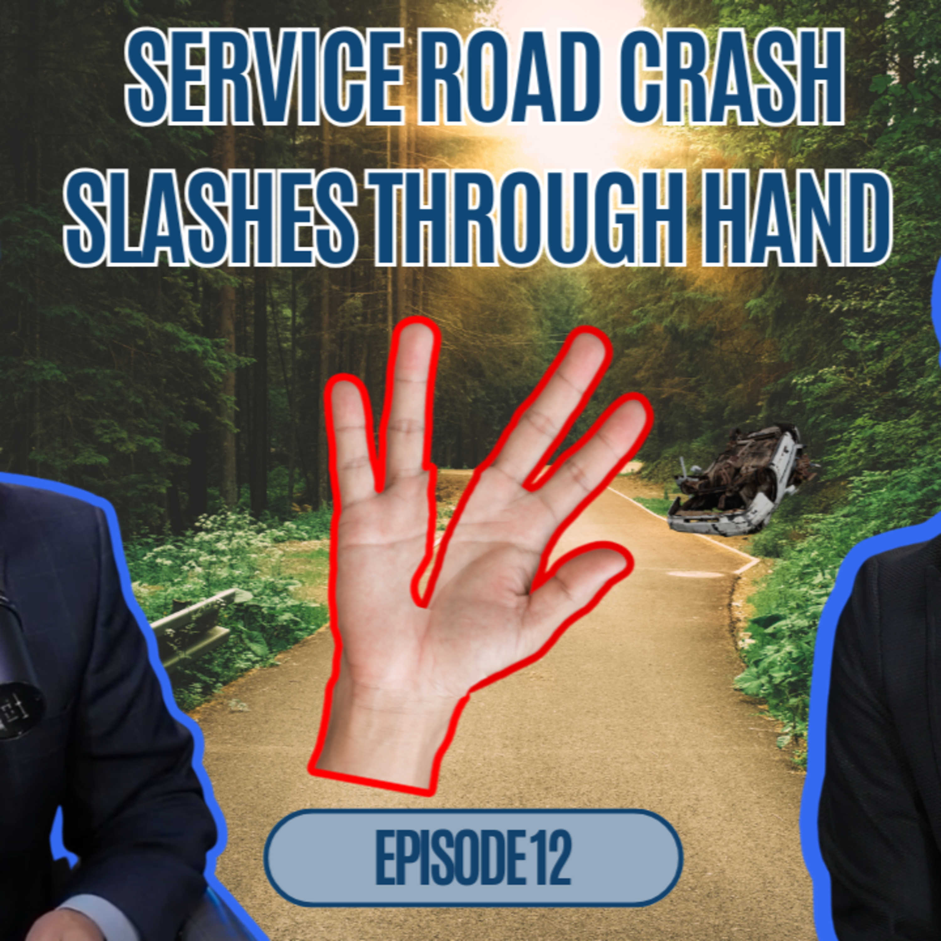 True Claims Podcast Episode 12- Forest Service Road Wreck Nearly Splits Hand in Half