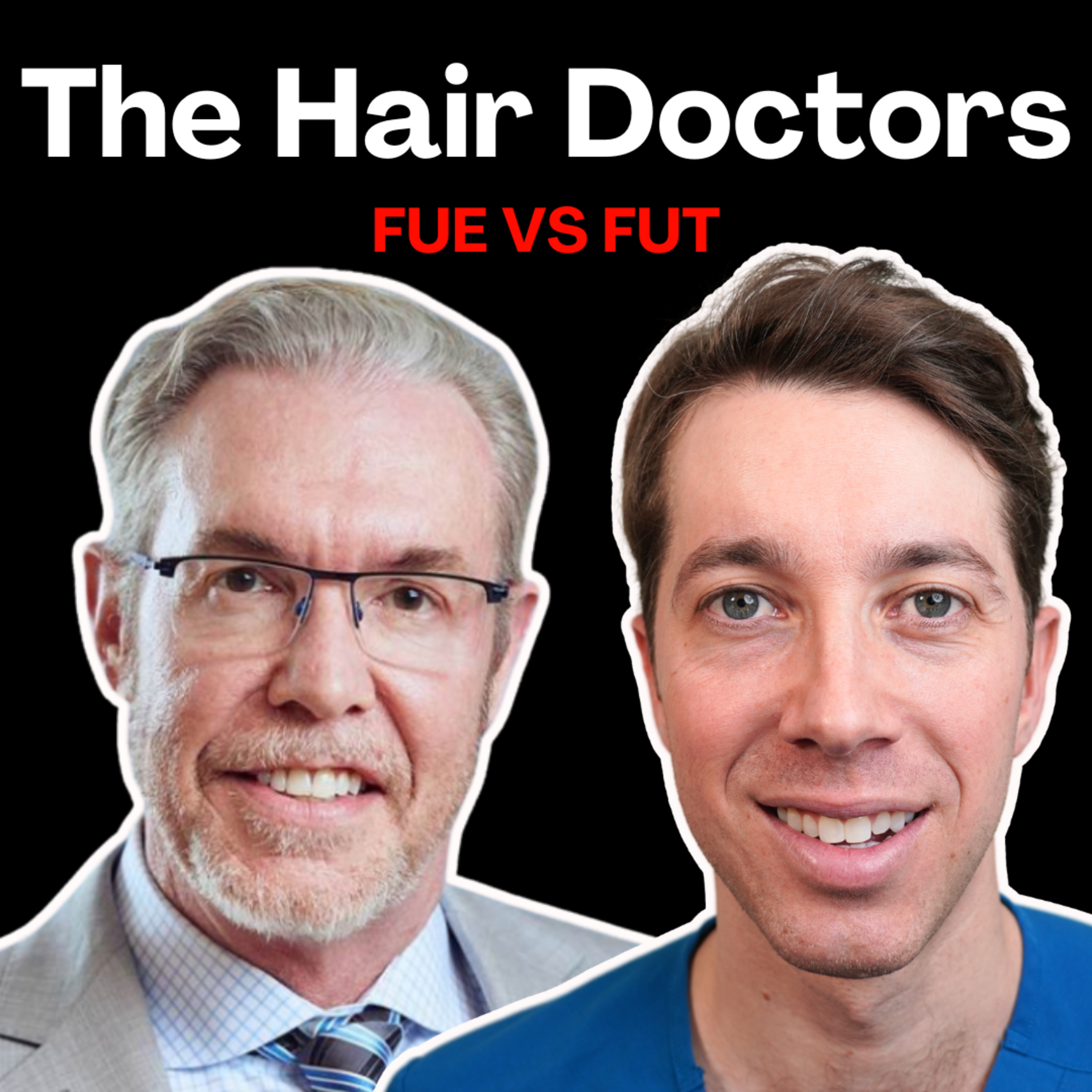 FUE vs FUT: Which Hair Transplant Method is Better?