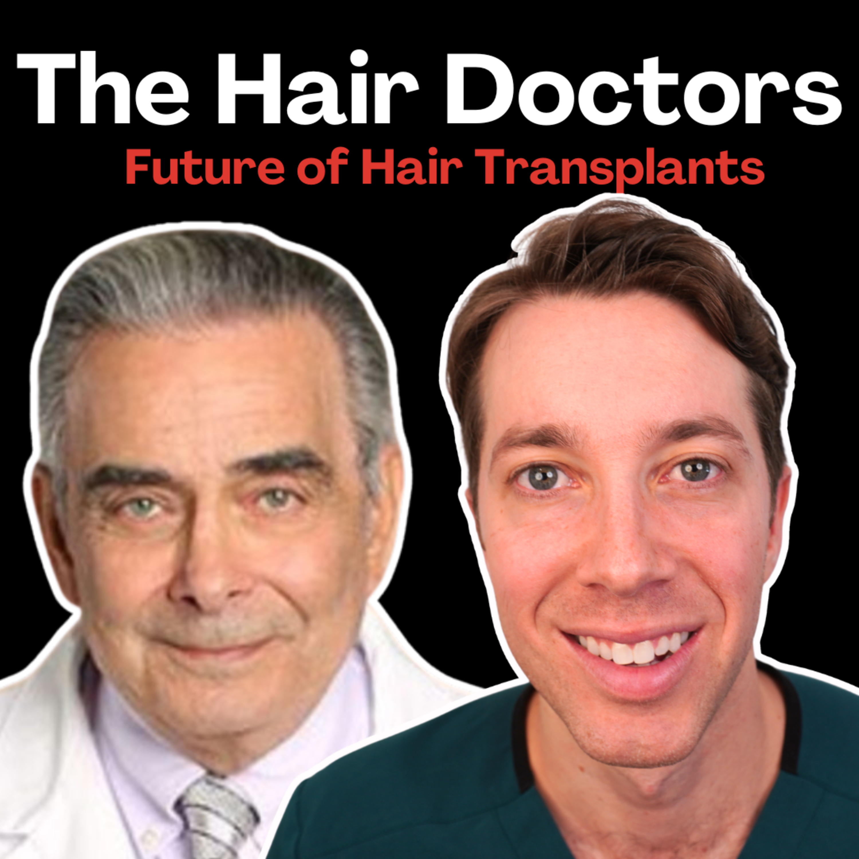 Future of Hair Transplants | Dr. William Rassman