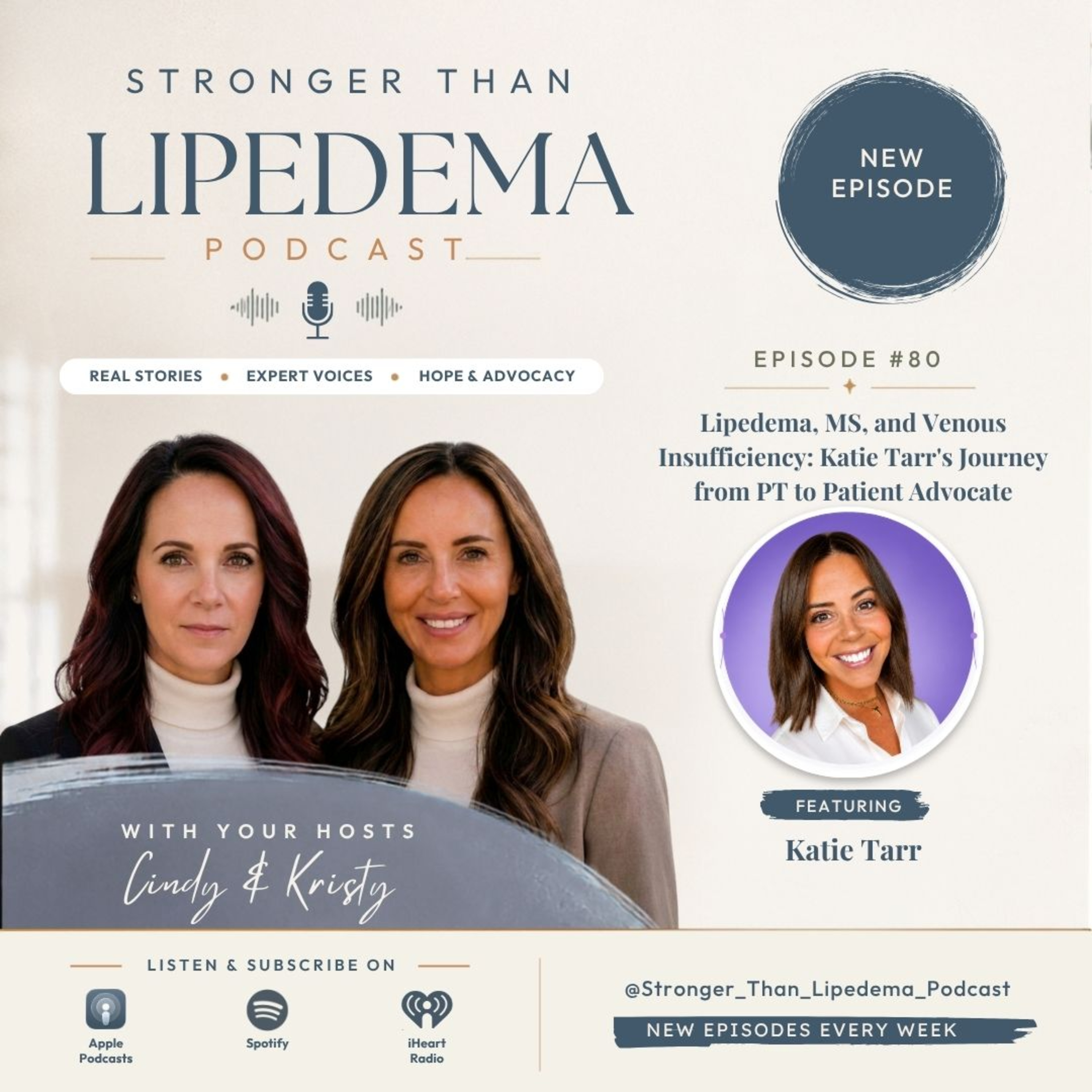 Lipedema, MS, and Venous Insufficiency: Katie Tarr's Journey from PT to Patient Advocate