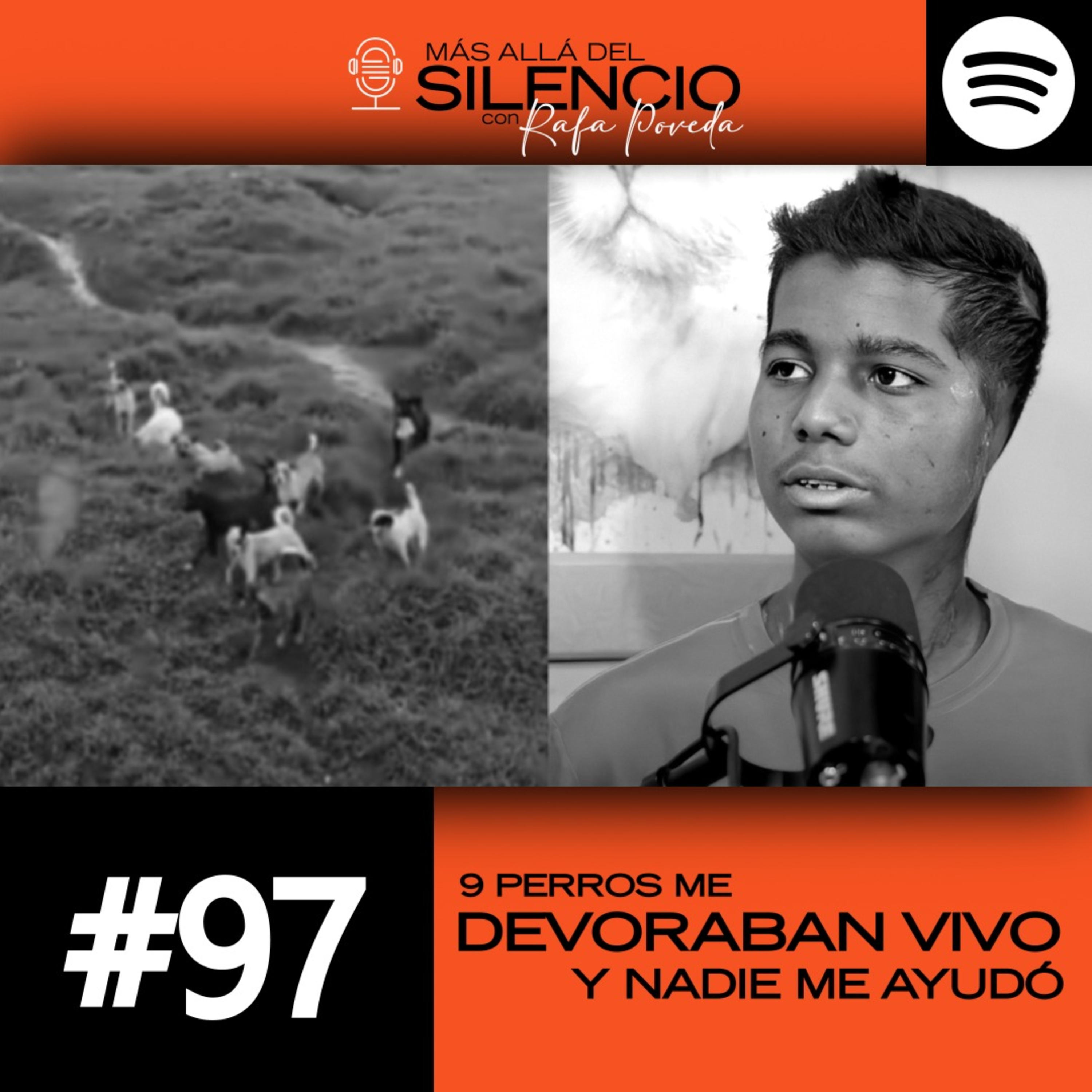 Así sobreviví a ataque de 9 hambrientos perros callejeros: 150 mordidas, y perdí mis brazos y orejas