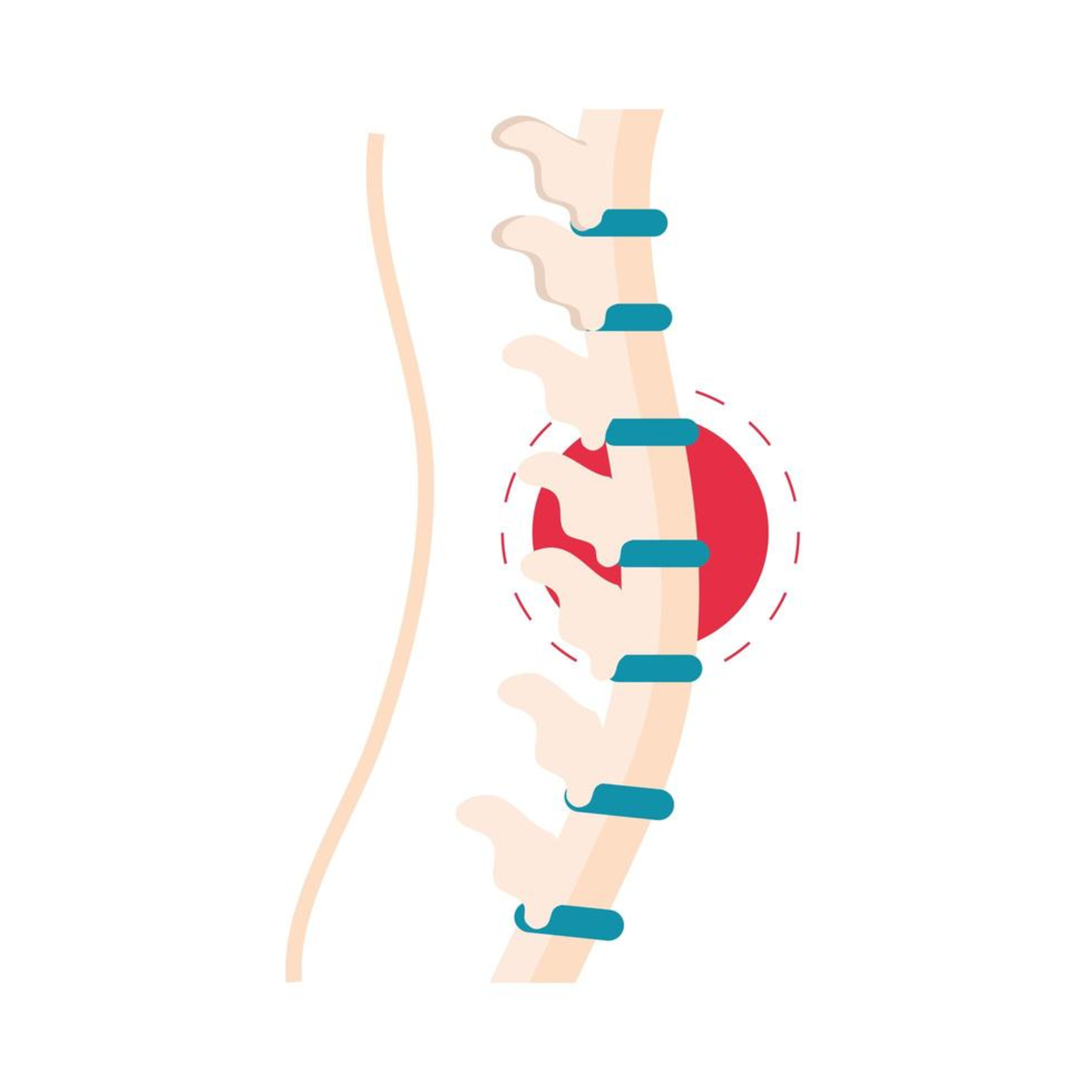 Spinal Cord Injury: Etiology, Pathophysiology, and Management