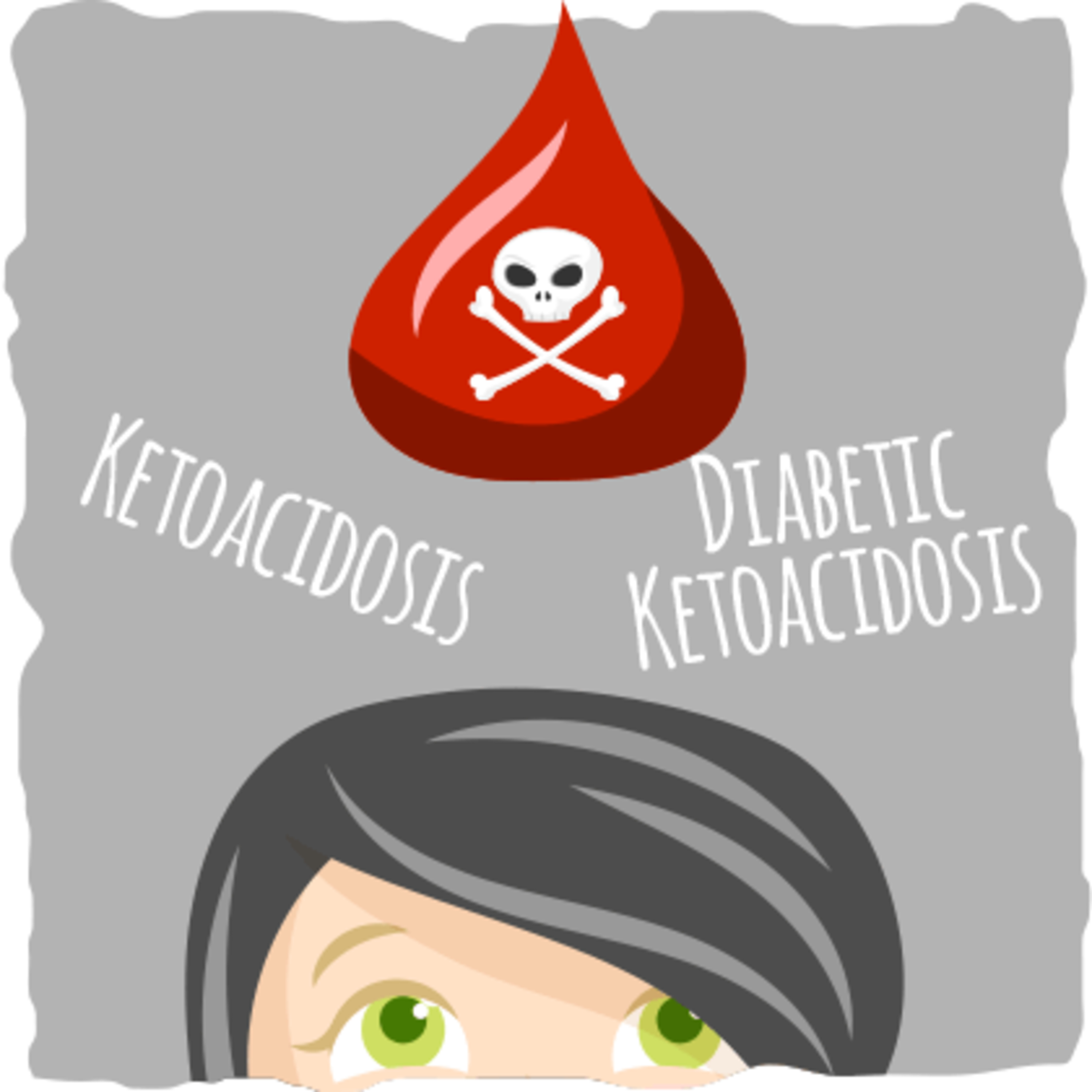 Diabetic Ketoacidosis, Hyperosmolar Hyperglycemic State, and Hypoglycemia