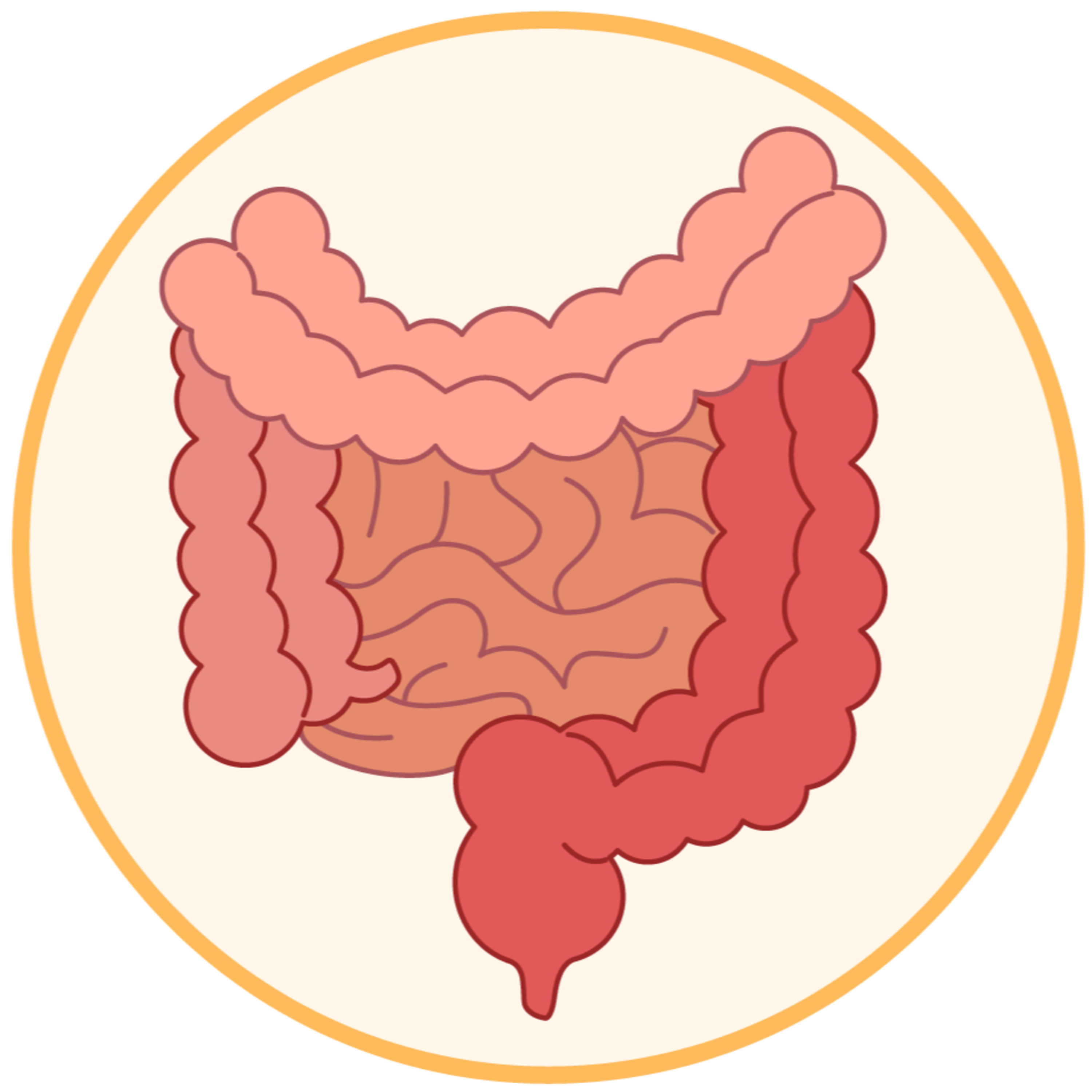 GI Issues - Part 2: Inflammatory Bowel Disease: Ulcerative Colitis and Crohn's Disease