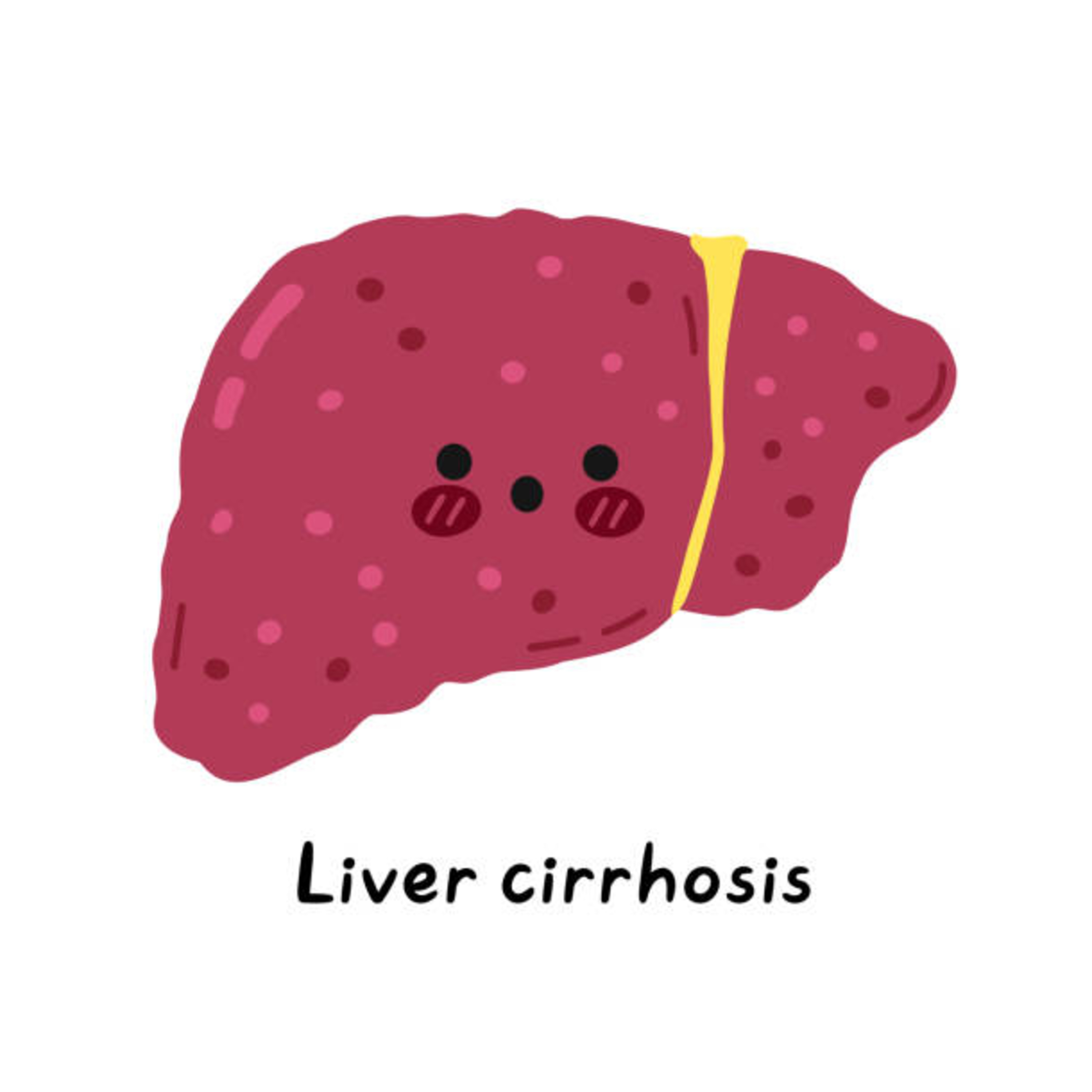 Cirrhosis of the Liver: Pathophysiology, Clinical Manifestations, and Management episode artwork