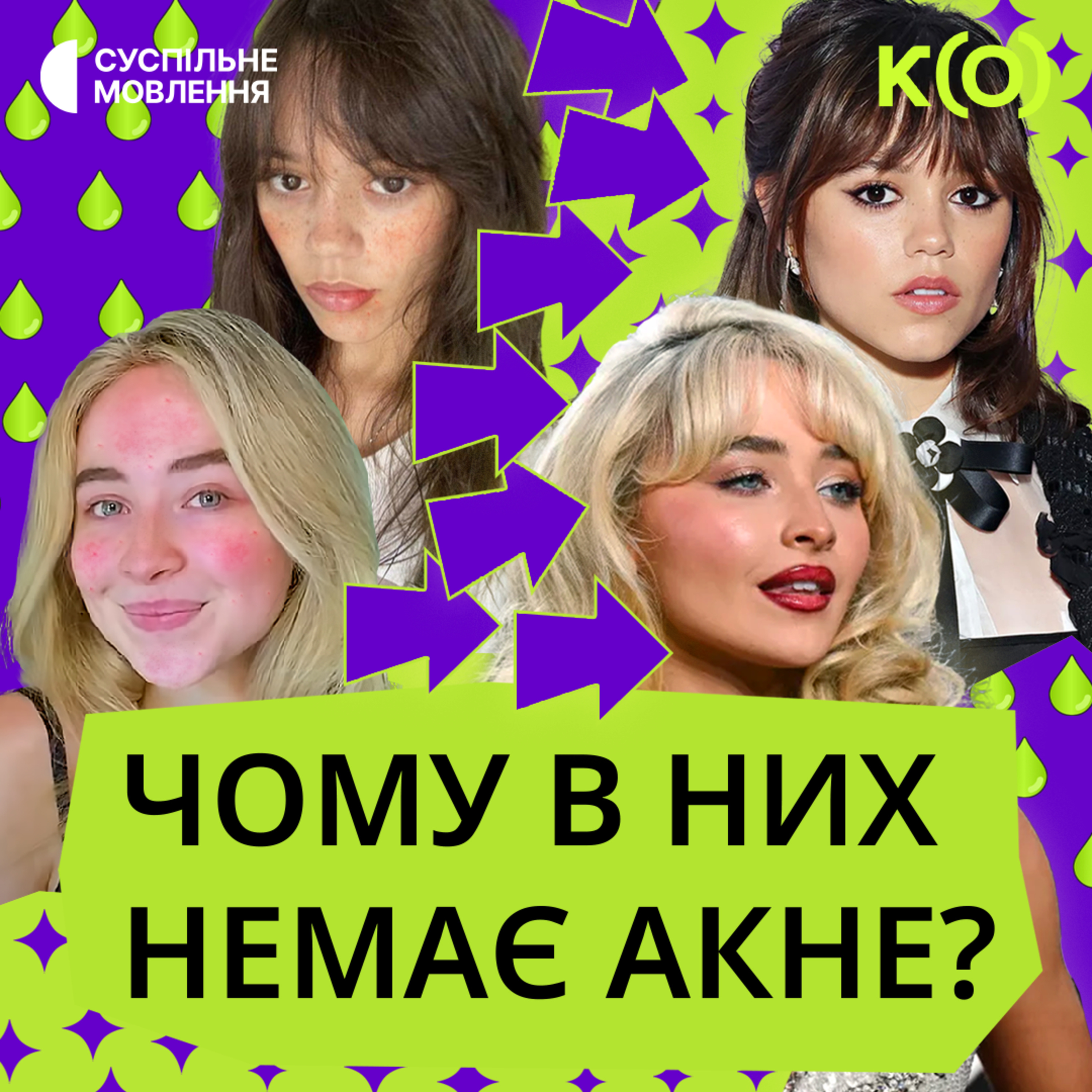 Про прищі та карієс | ТА НЕВЖЕ?