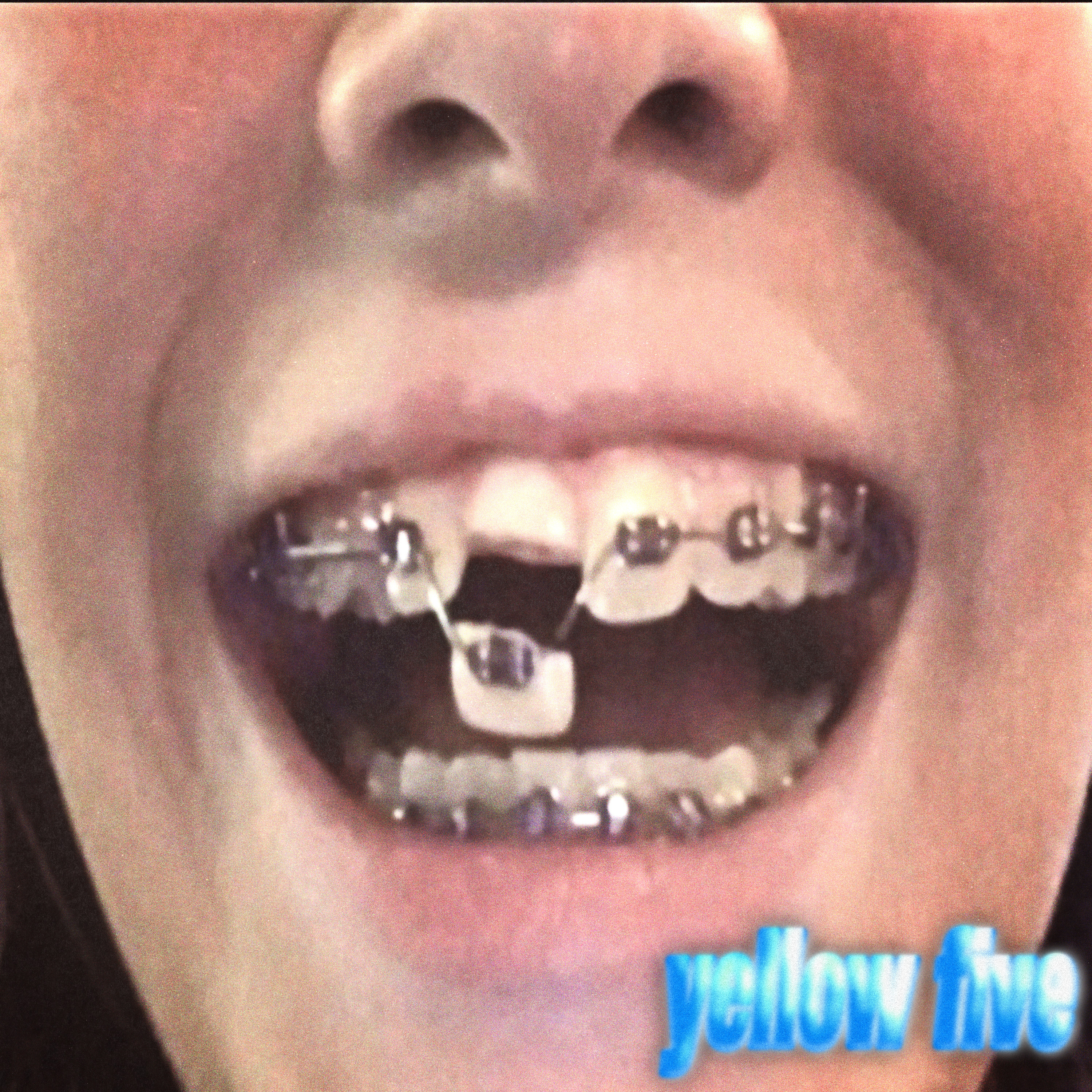 ₆ molly wop episode artwork