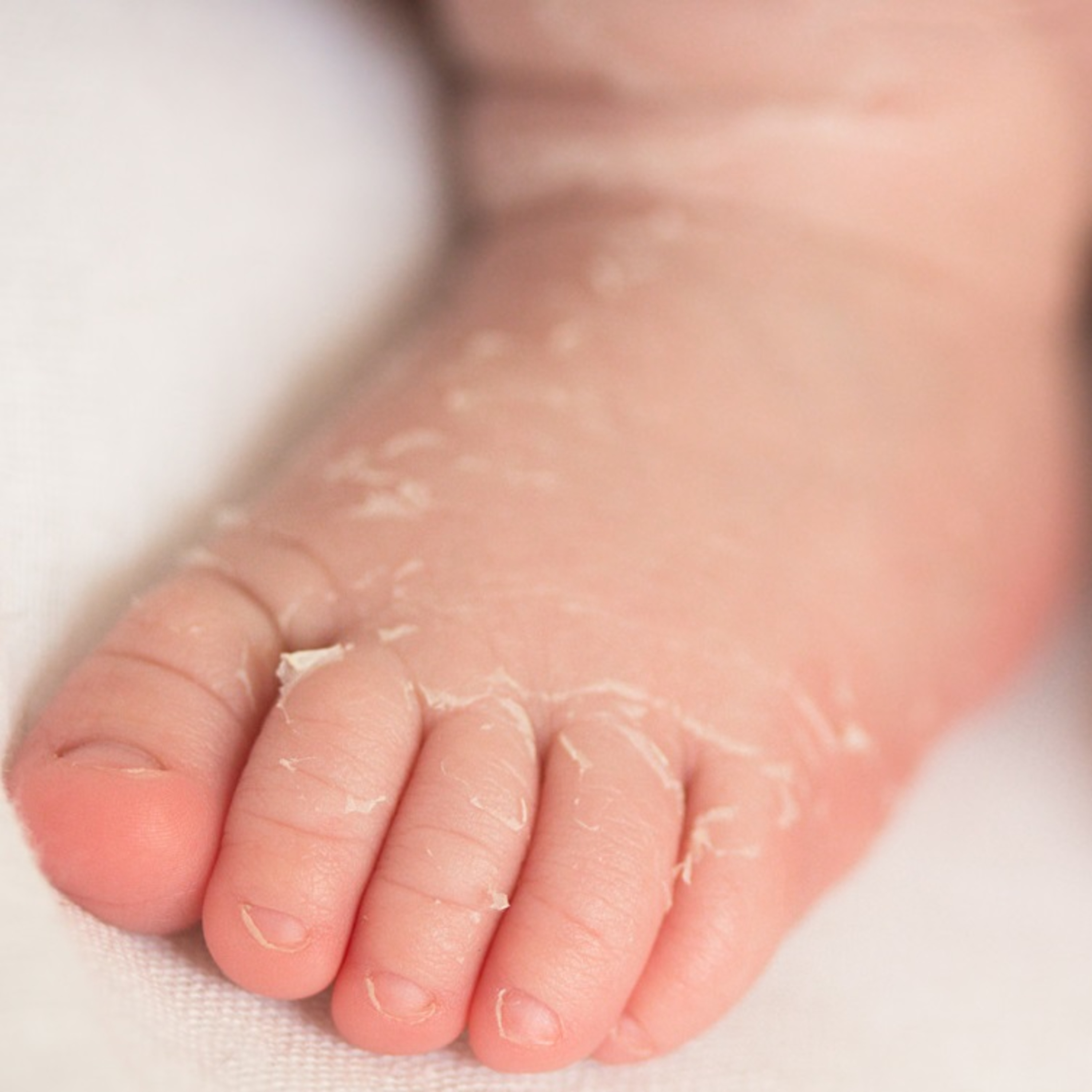 Ep 8: Newborn Skin Care episode artwork