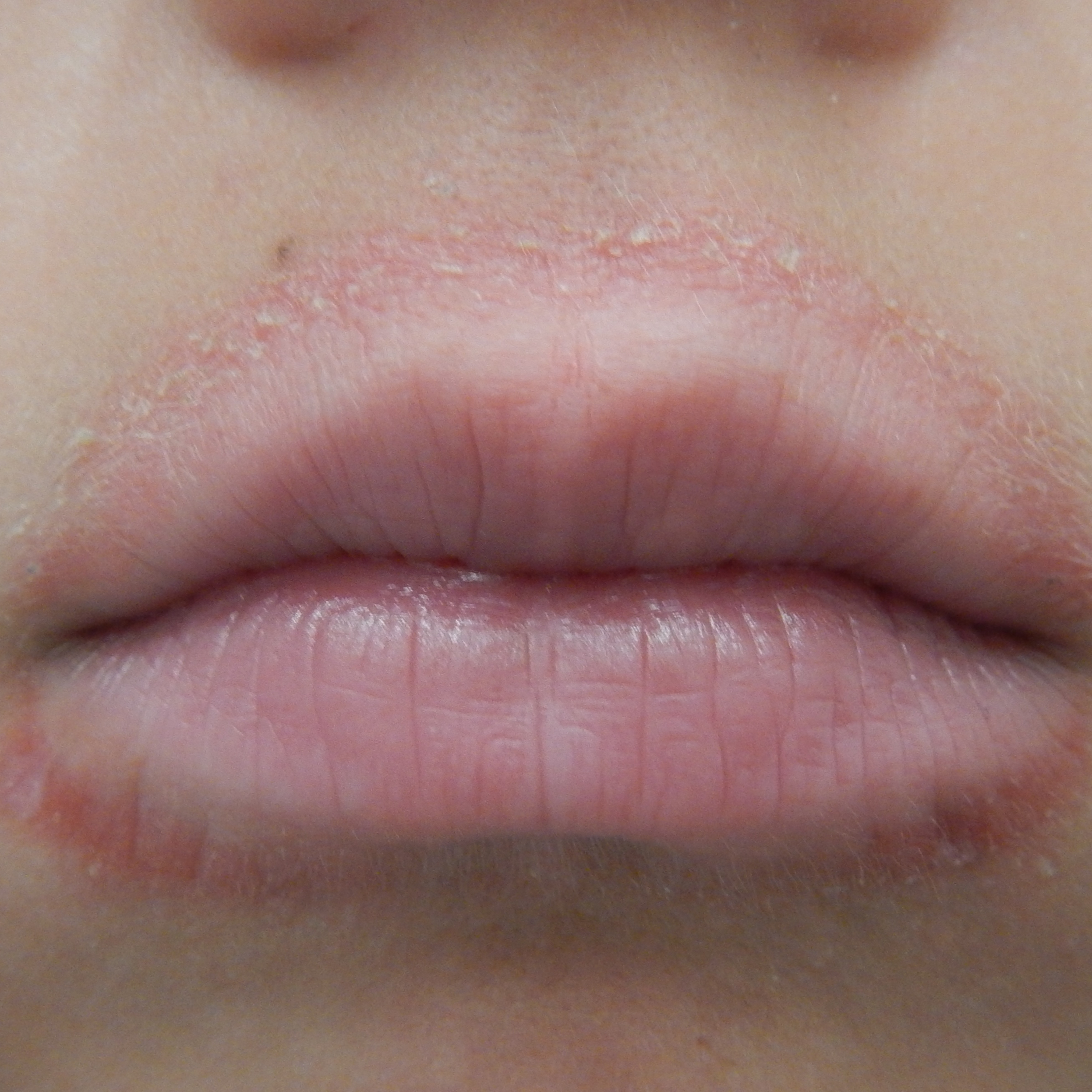 Ep 78: Medical Mysteries: Funky Lip Rash! episode artwork