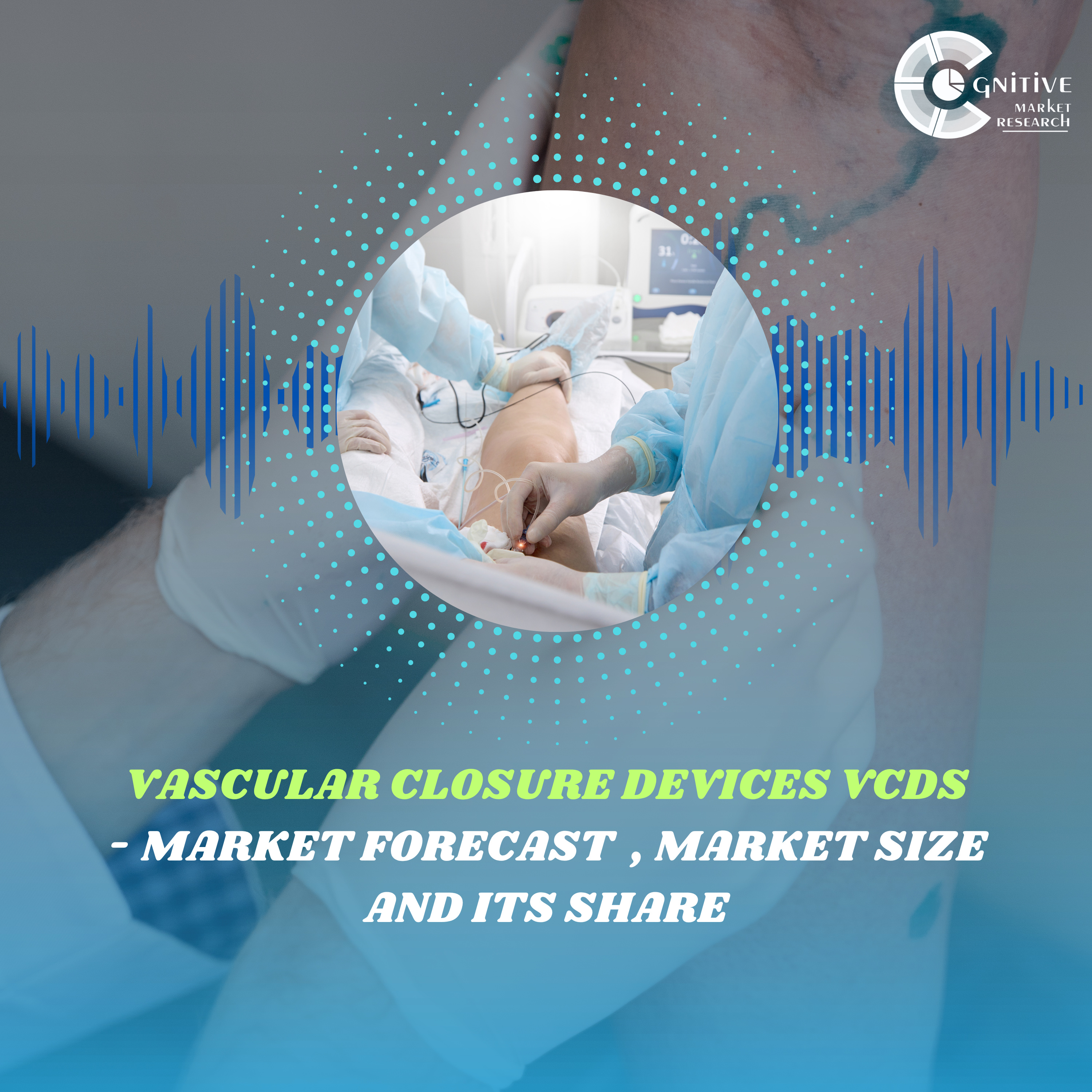 Vascular Closure Devices VCDS Market Forecast , Market Size and its Share episode artwork