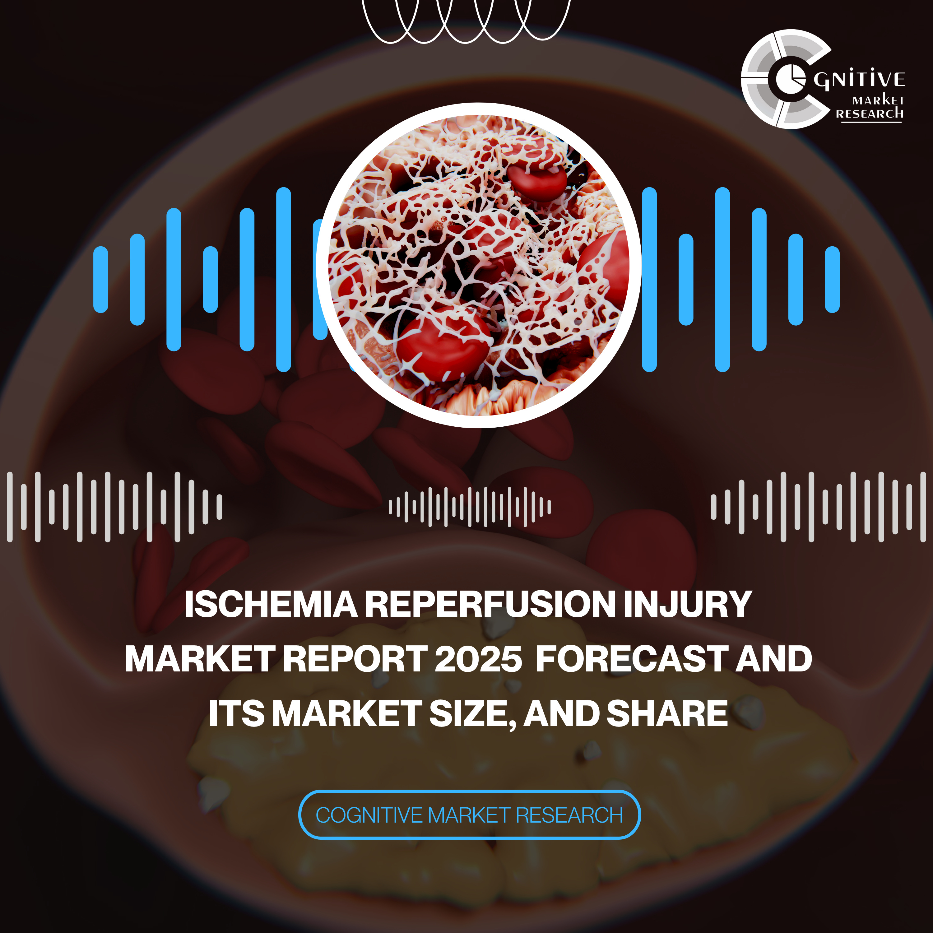 Ischemia Reperfusion Injury Market Report 2025 Forecast and its Market Size, and Share episode artwork