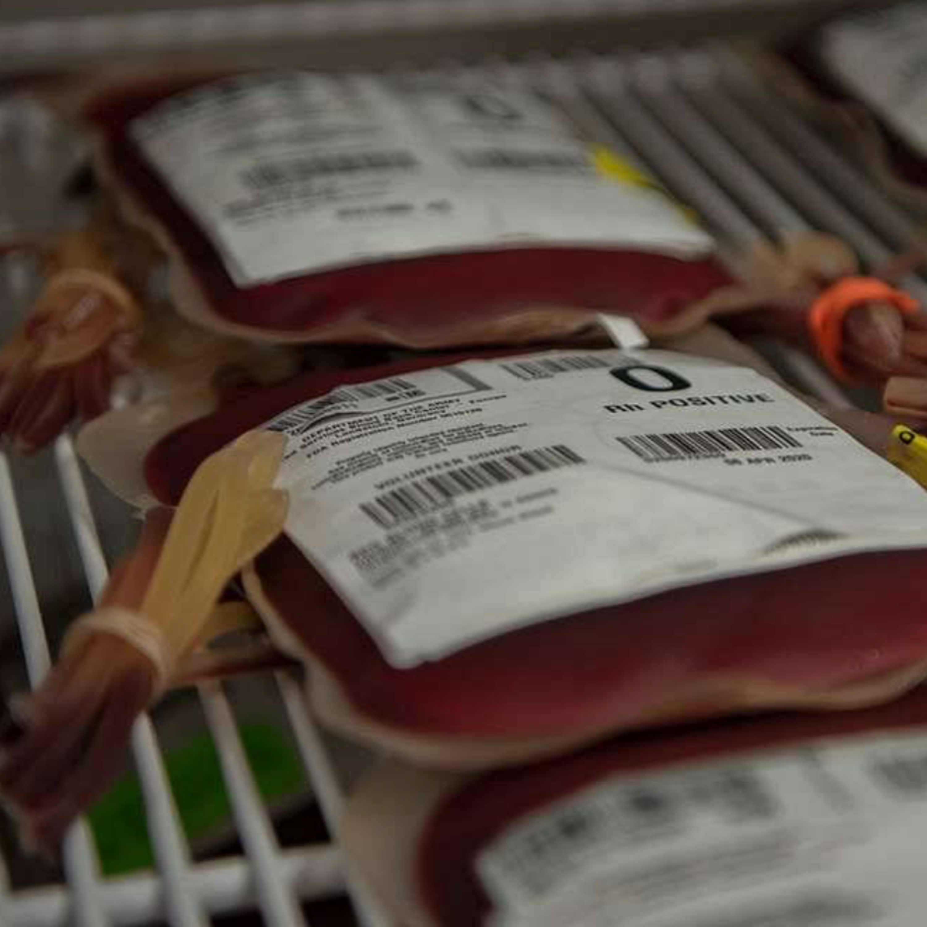 260. Massive Transfusion Protocol in the ED