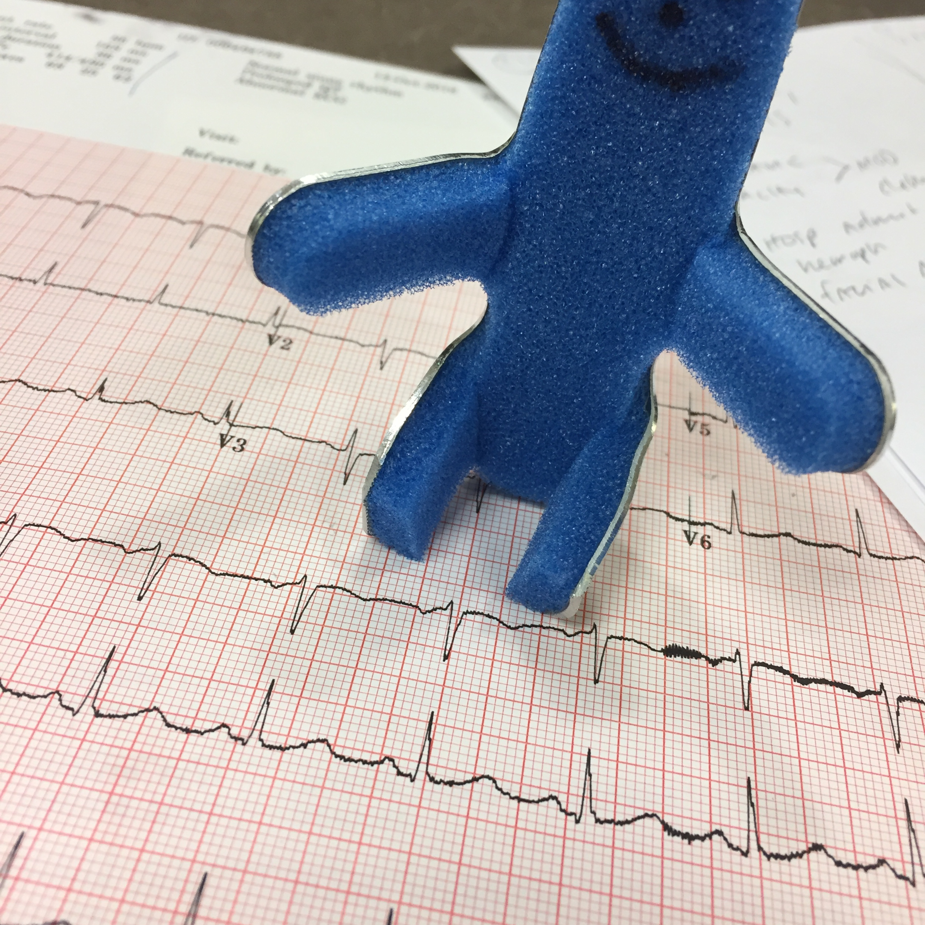 286. The PE ECG Finding Everyone Memorizes… But Gets Wrong