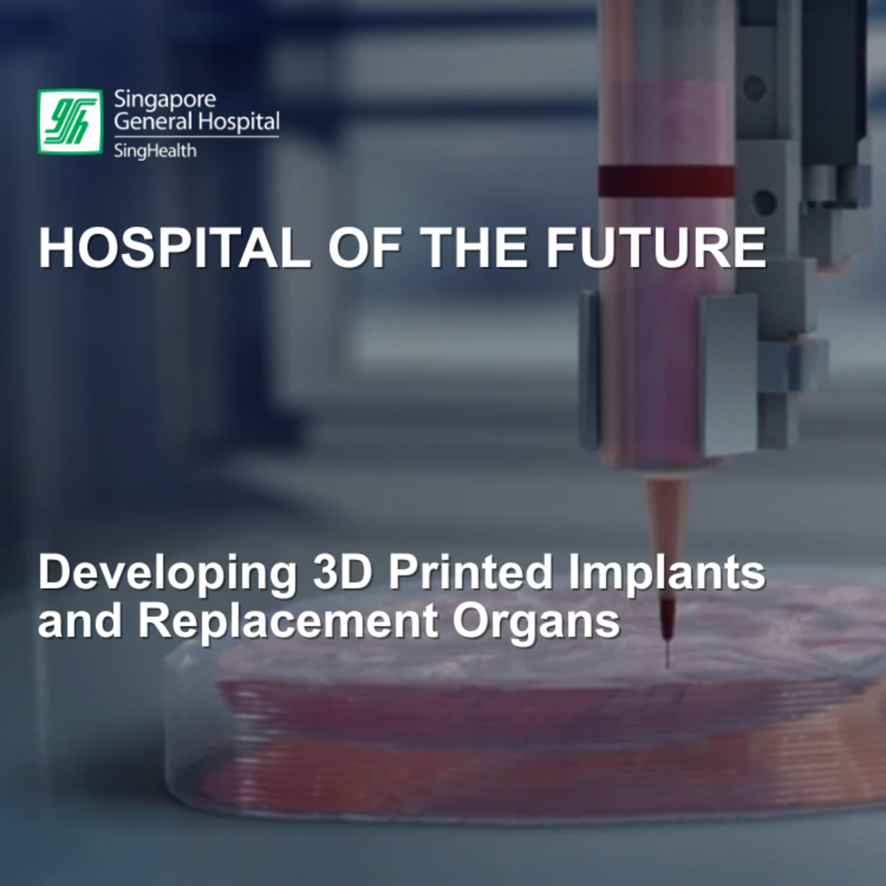 Developing 3D Printed Implants and Replacement Organs
