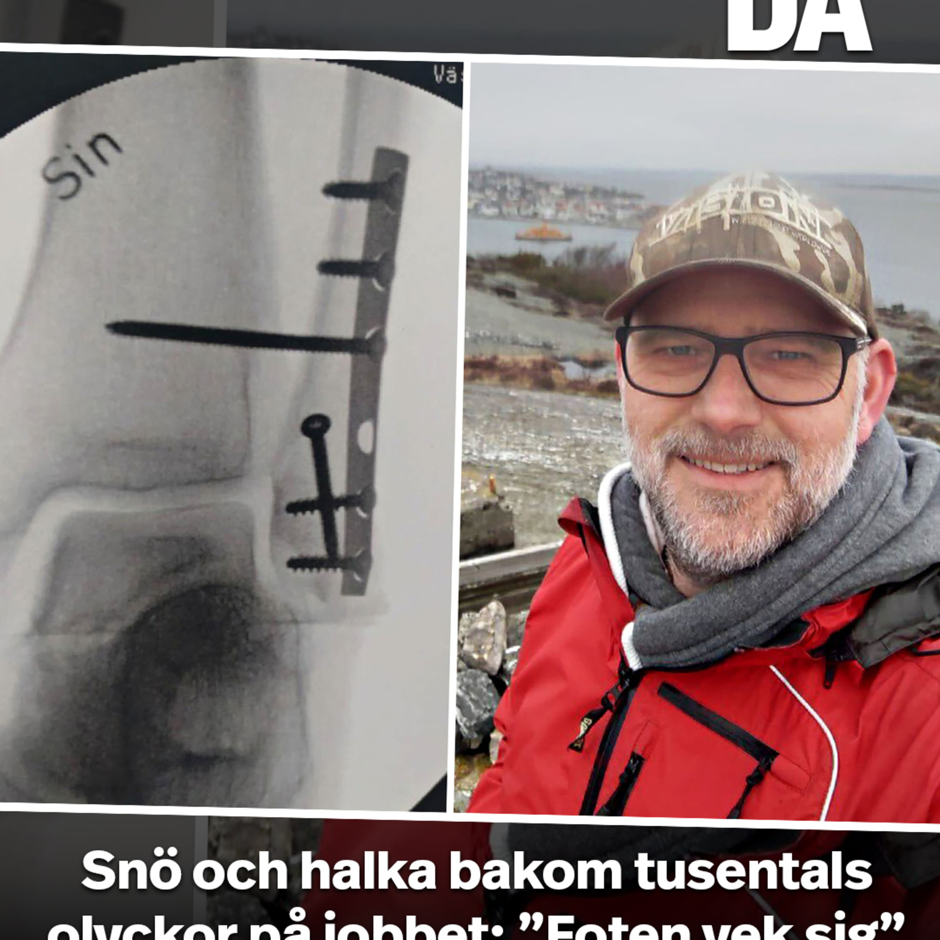 Snö och halka bakom tusentals olyckor på jobbet: ”Foten vek sig”