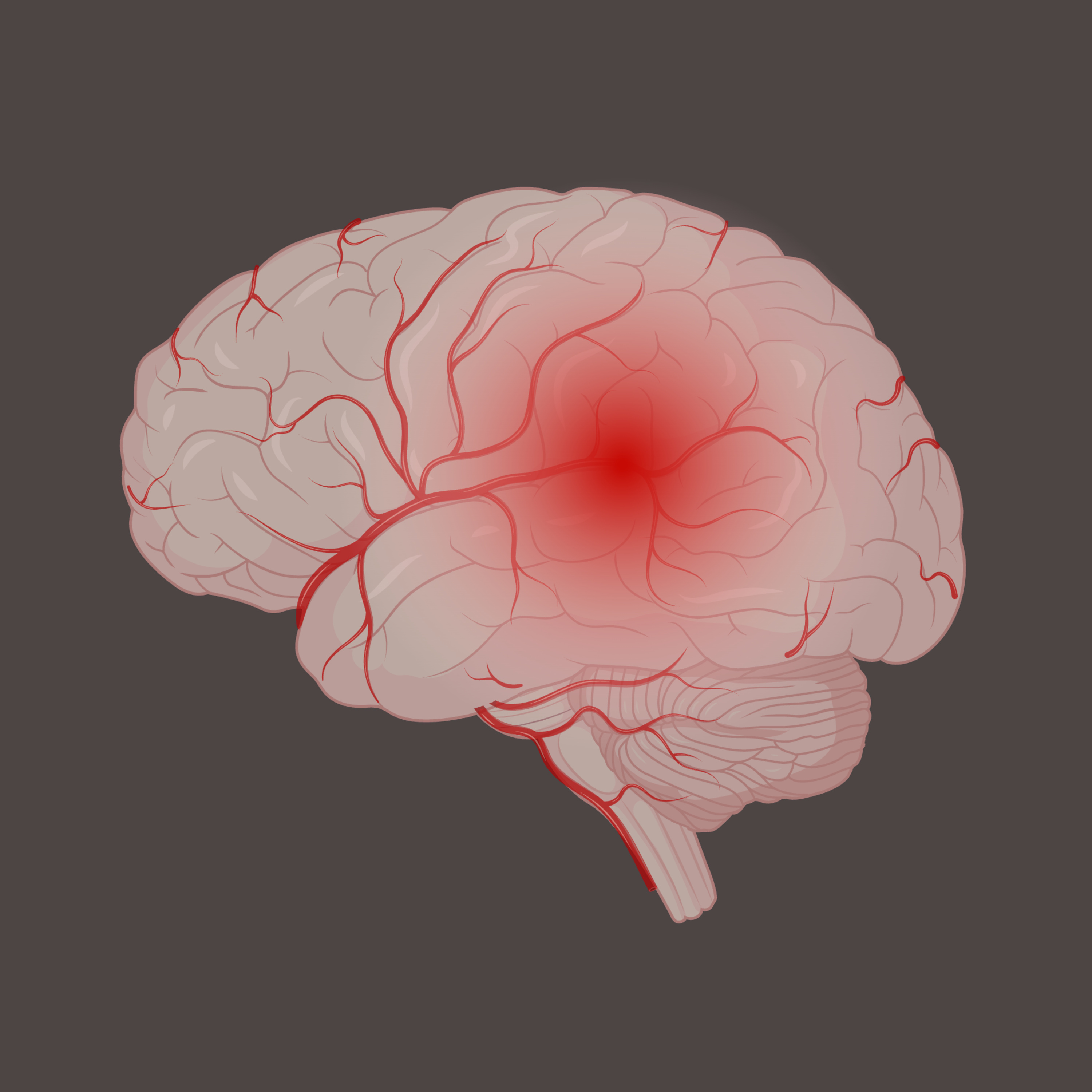 The secrets of alzheimer\'s disease