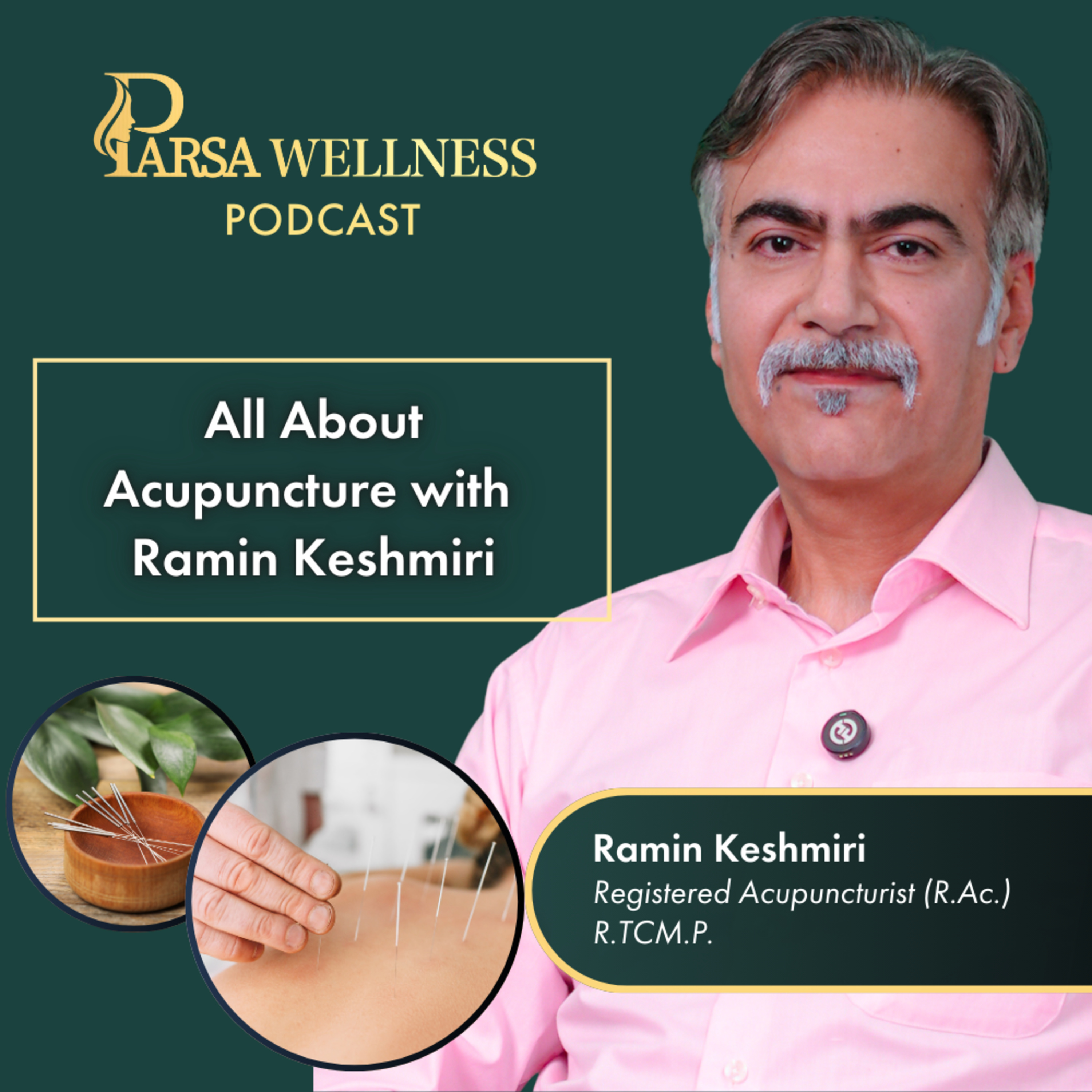 Acupuncture and Holistic Healing with Ramin Keshmiri at Parsa Wellness