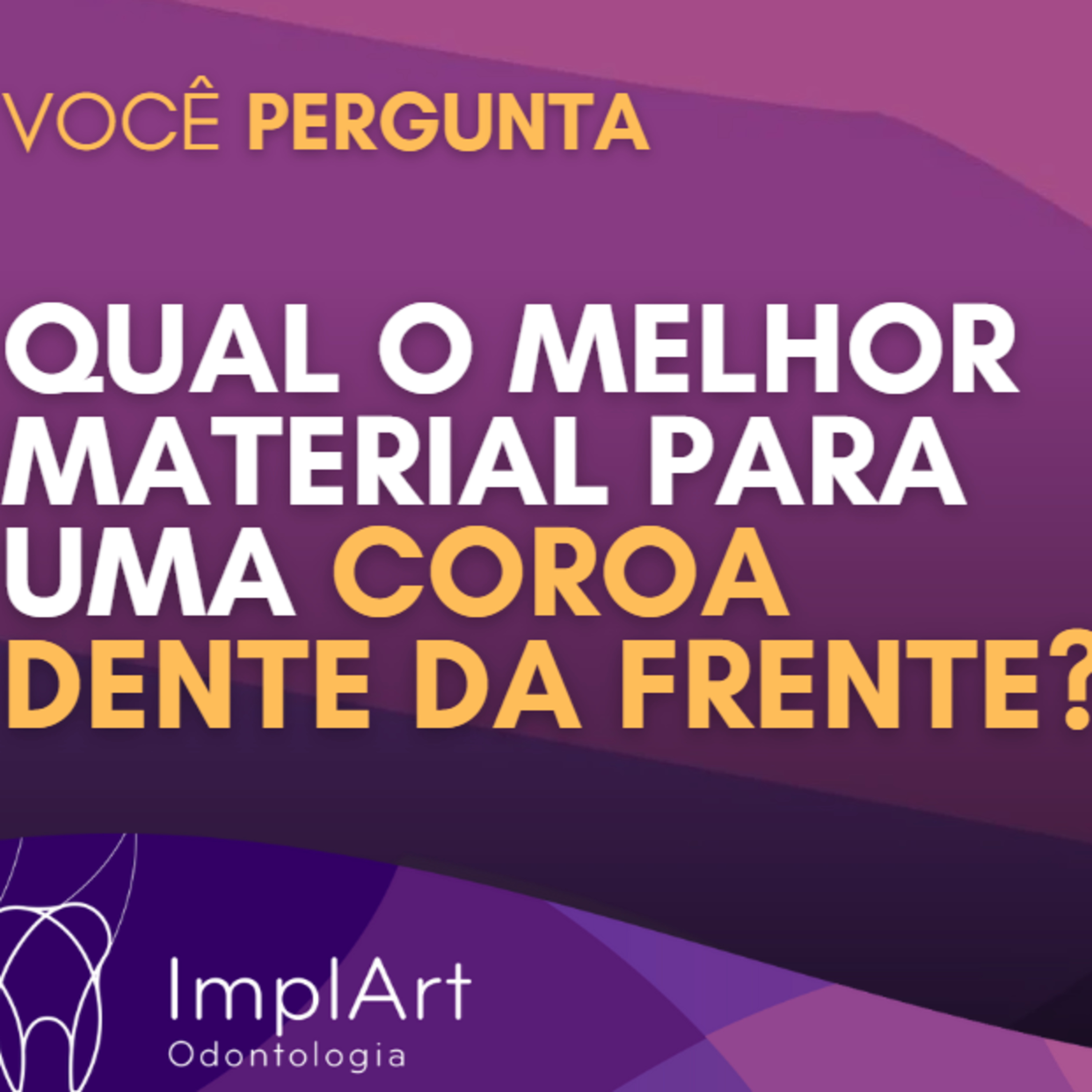 IMPLANTE DENTÁRIO PODCAST - Clínica ImplArt - Sorriso Digital e Implantes Dentários com Tecnologia