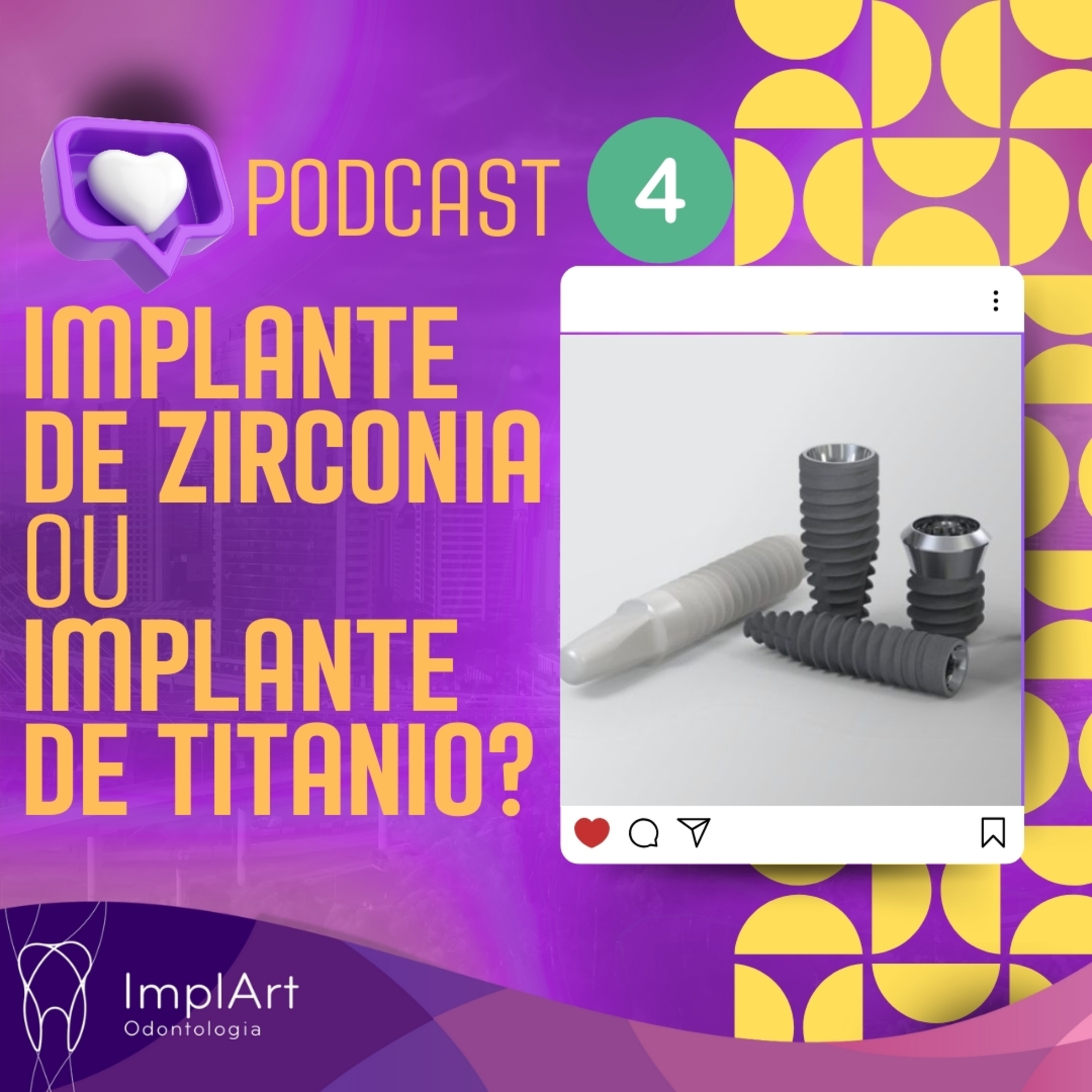 IMPLANTE DENTÁRIO PODCAST - Clínica ImplArt - Sorriso Digital e Implantes Dentários com Tecnologia