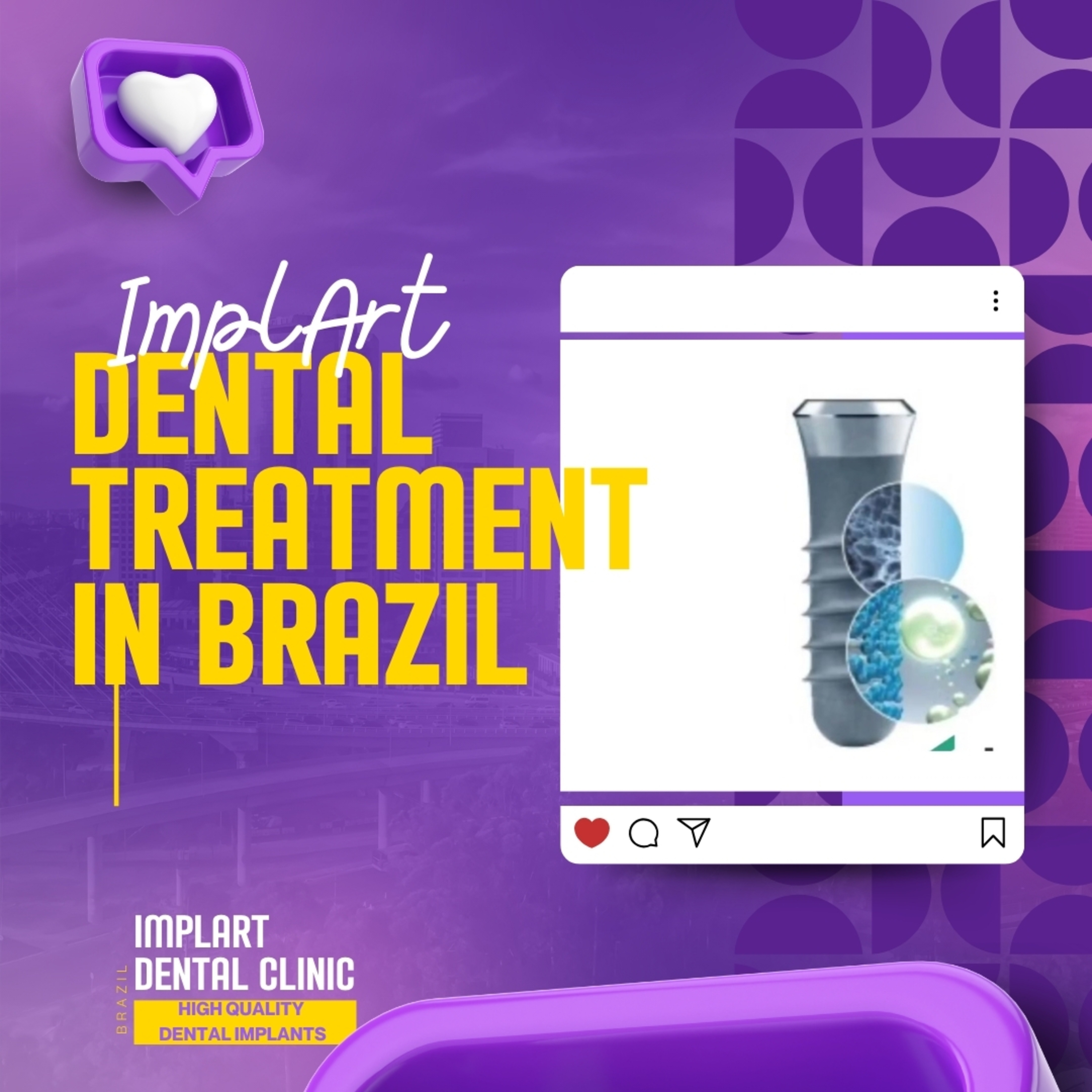 IMPLANTE DENTÁRIO PODCAST - Clínica ImplArt - Sorriso Digital e Implantes Dentários com Tecnologia