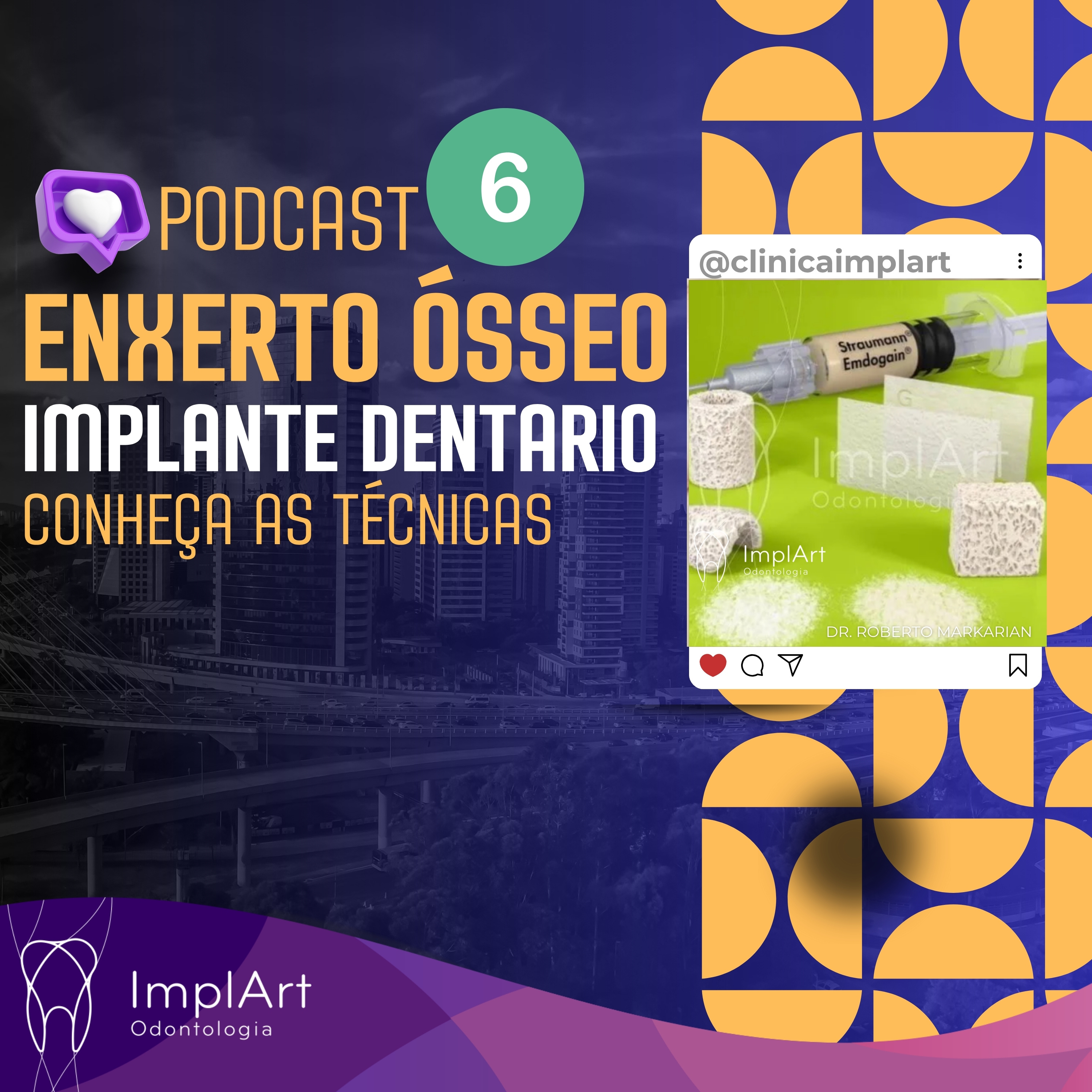 IMPLANTE DENTÁRIO PODCAST - Clínica ImplArt - Sorriso Digital e Implantes Dentários com Tecnologia