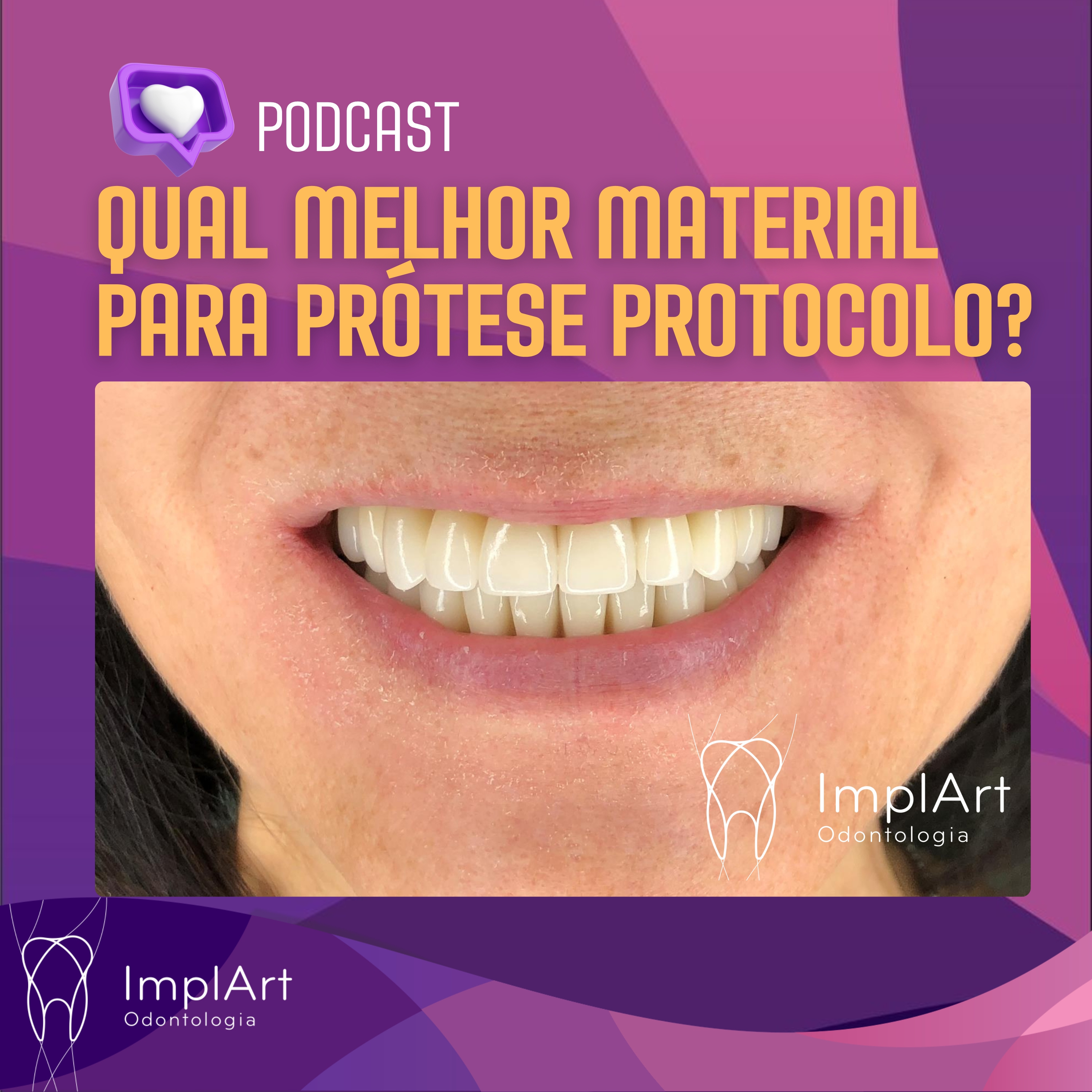 IMPLANTE DENTÁRIO PODCAST - Clínica ImplArt - Sorriso Digital e Implantes Dentários com Tecnologia