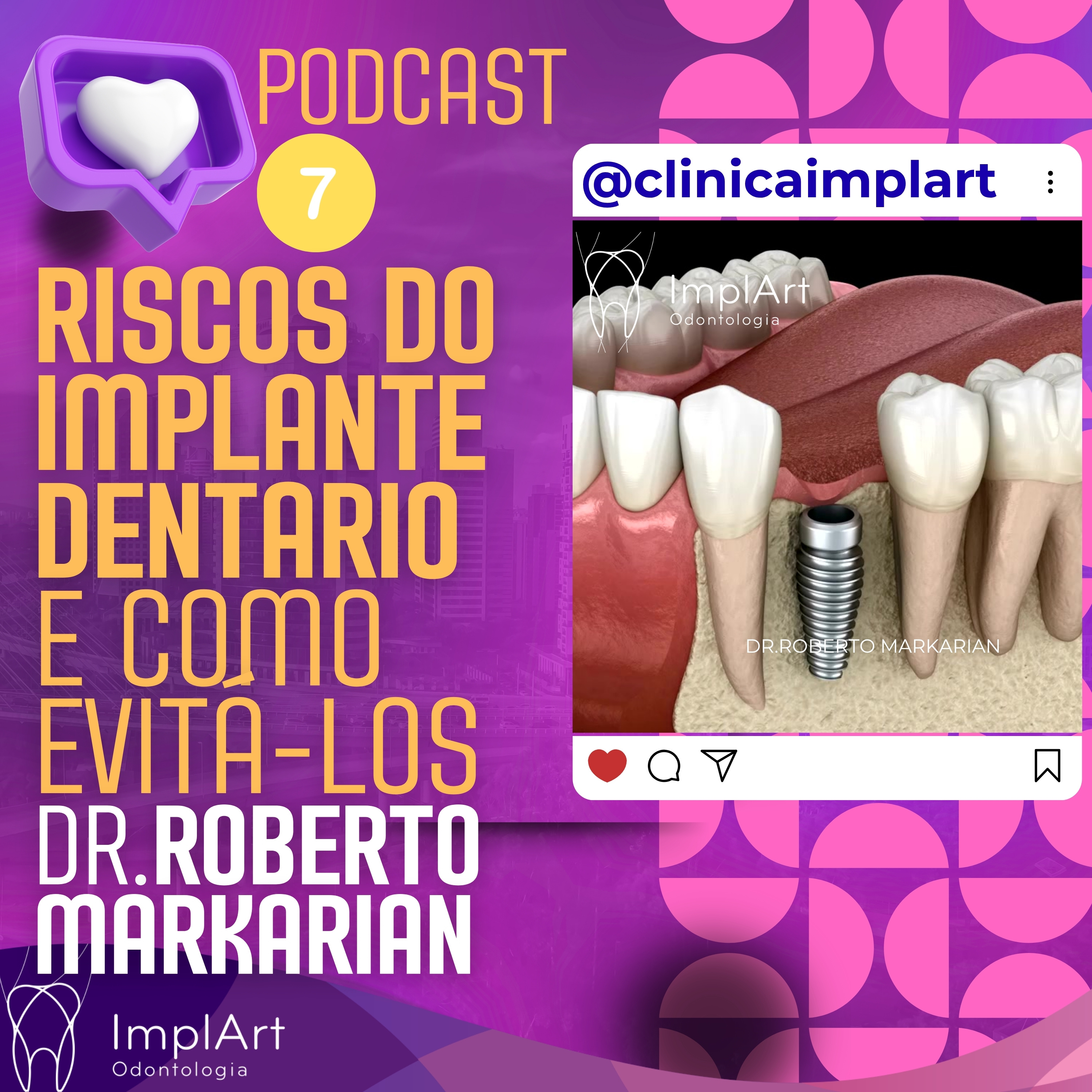 IMPLANTE DENTÁRIO PODCAST - Clínica ImplArt - Sorriso Digital e Implantes Dentários com Tecnologia