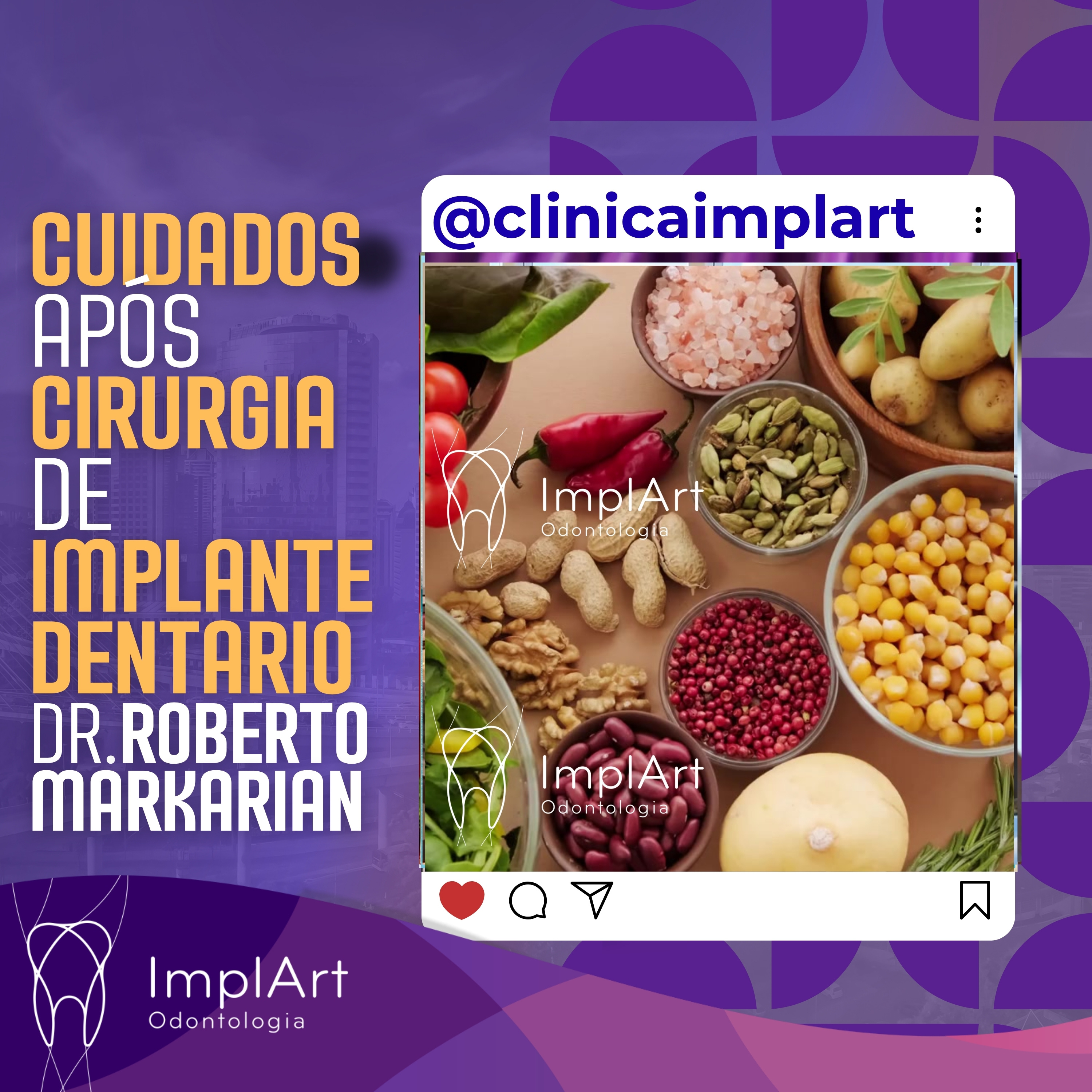 IMPLANTE DENTÁRIO PODCAST - Clínica ImplArt - Sorriso Digital e Implantes Dentários com Tecnologia