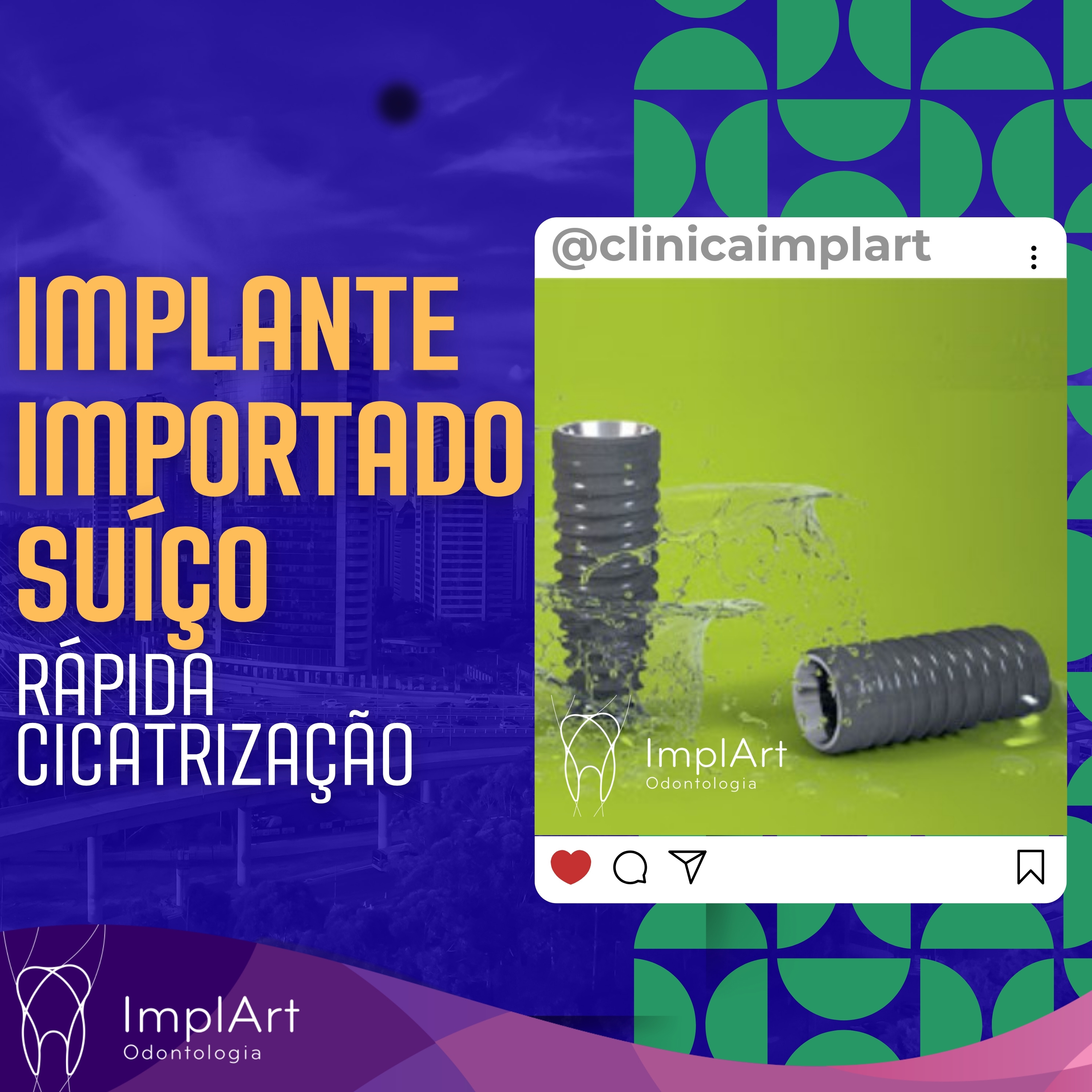 IMPLANTE DENTÁRIO PODCAST - Clínica ImplArt - Sorriso Digital e Implantes Dentários com Tecnologia