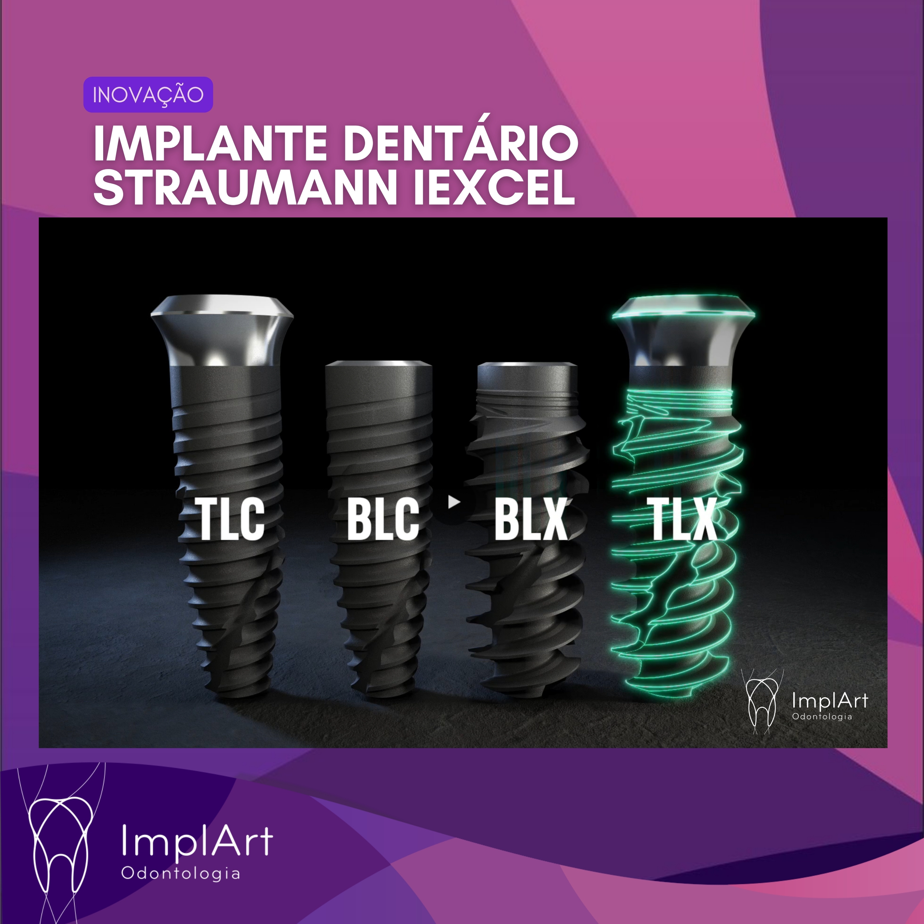 IMPLANTE DENTÁRIO PODCAST - Clínica ImplArt - Sorriso Digital e Implantes Dentários com Tecnologia