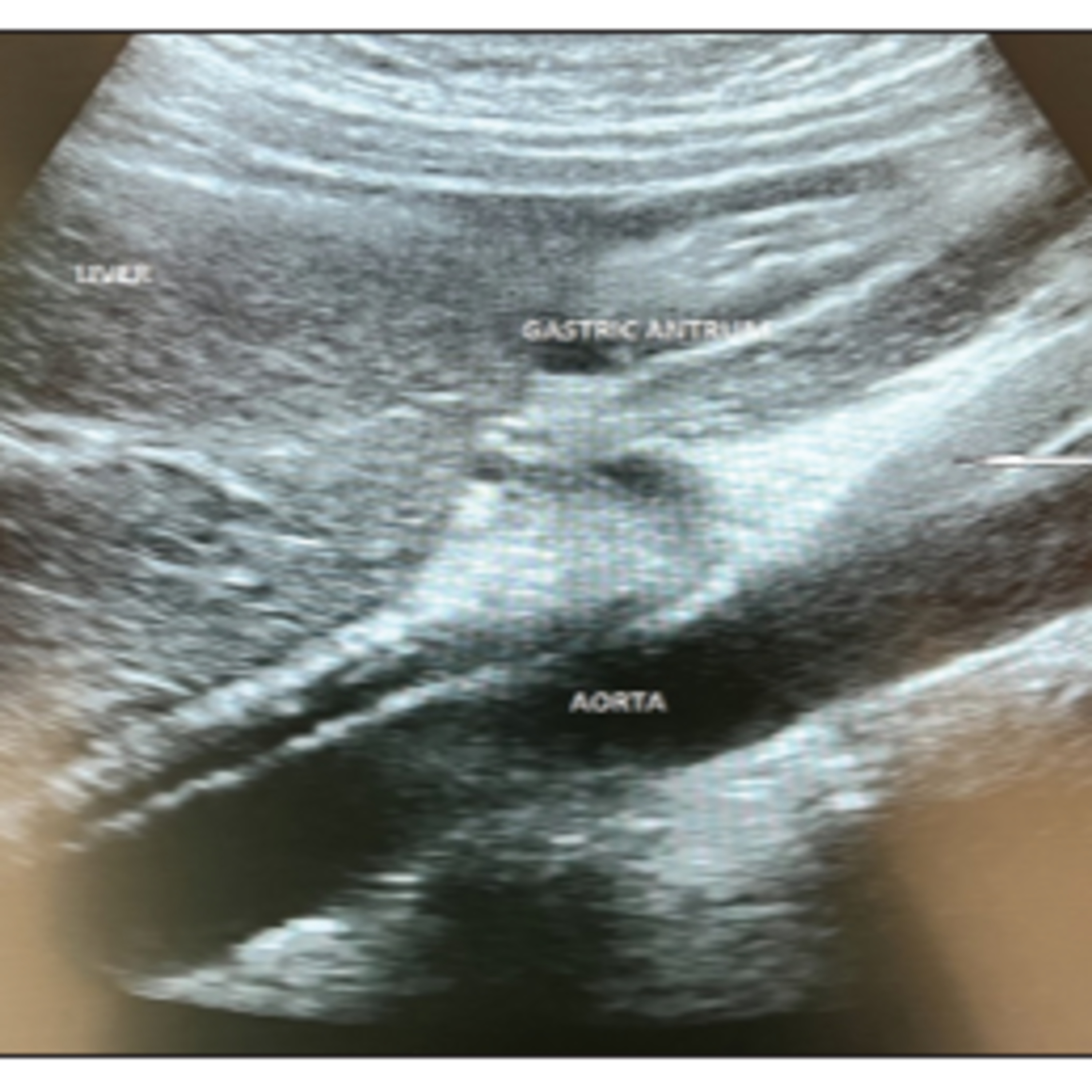 Simple Science Deep Dive