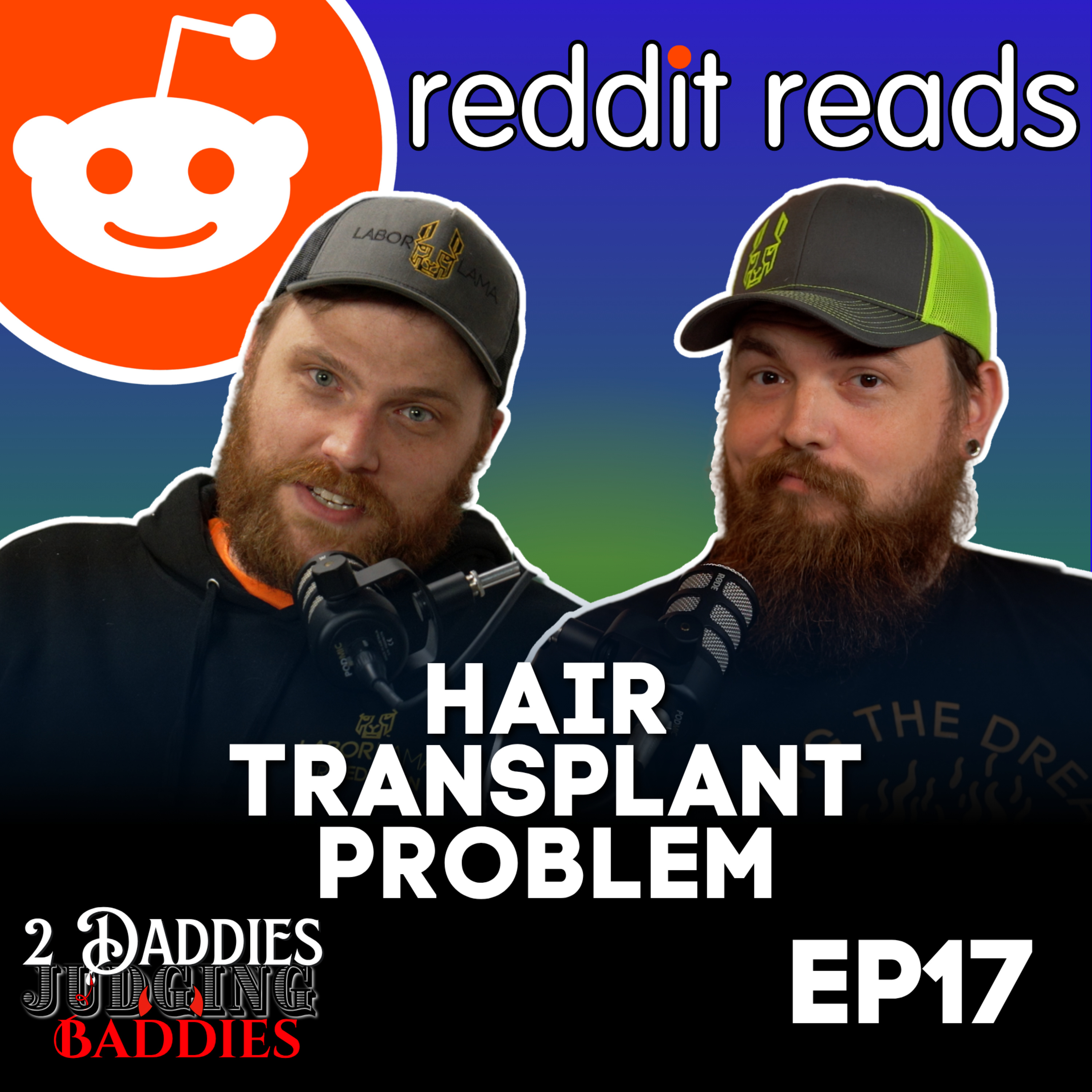 AITA : Husband's Hair Transplant Drama & Mr Beast Ruins A Marriage | Reading Reddit Stories | 2DJB Ep17 | episode artwork