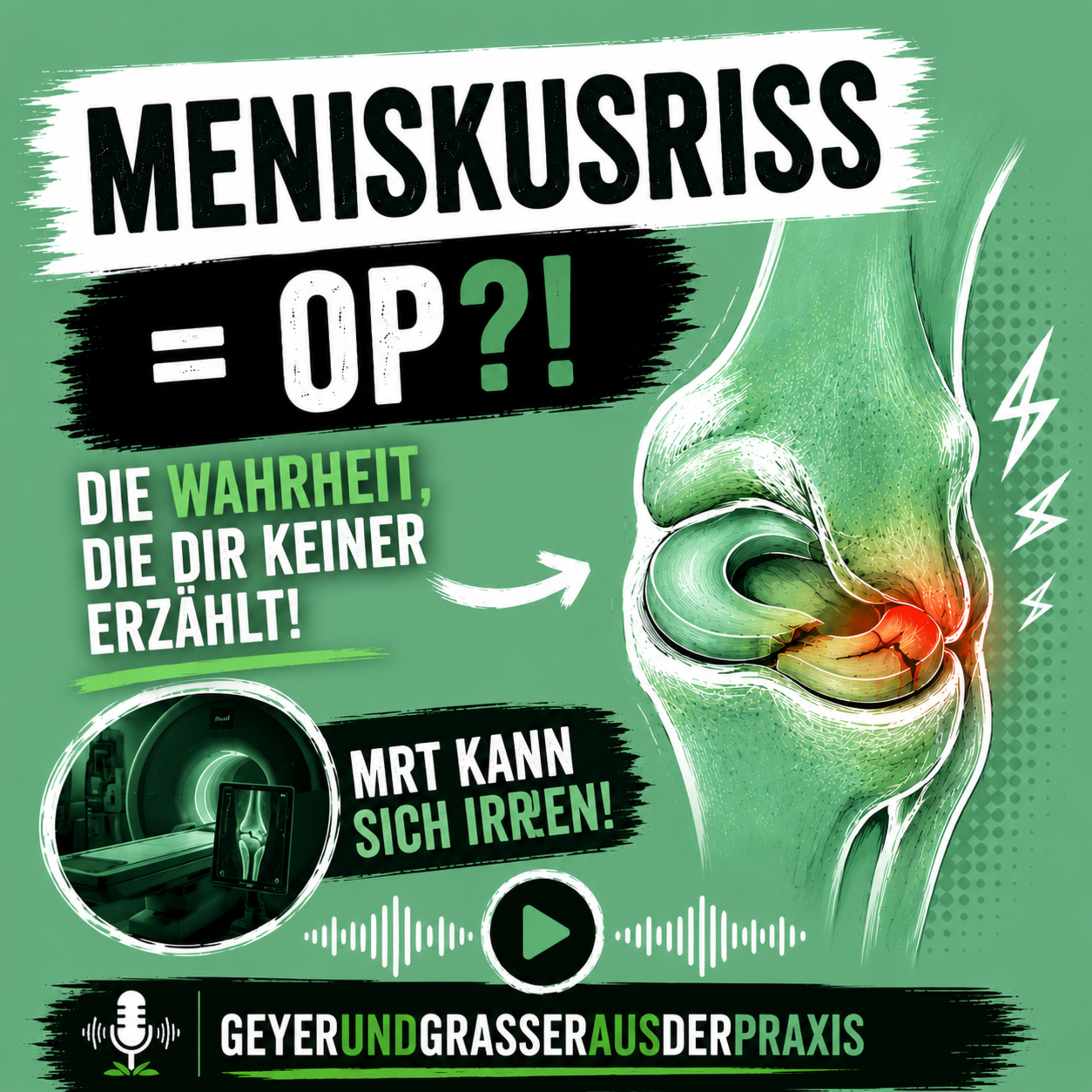 🎯Meniskusriss? Warum so viele völlig unnötig operiert werden…