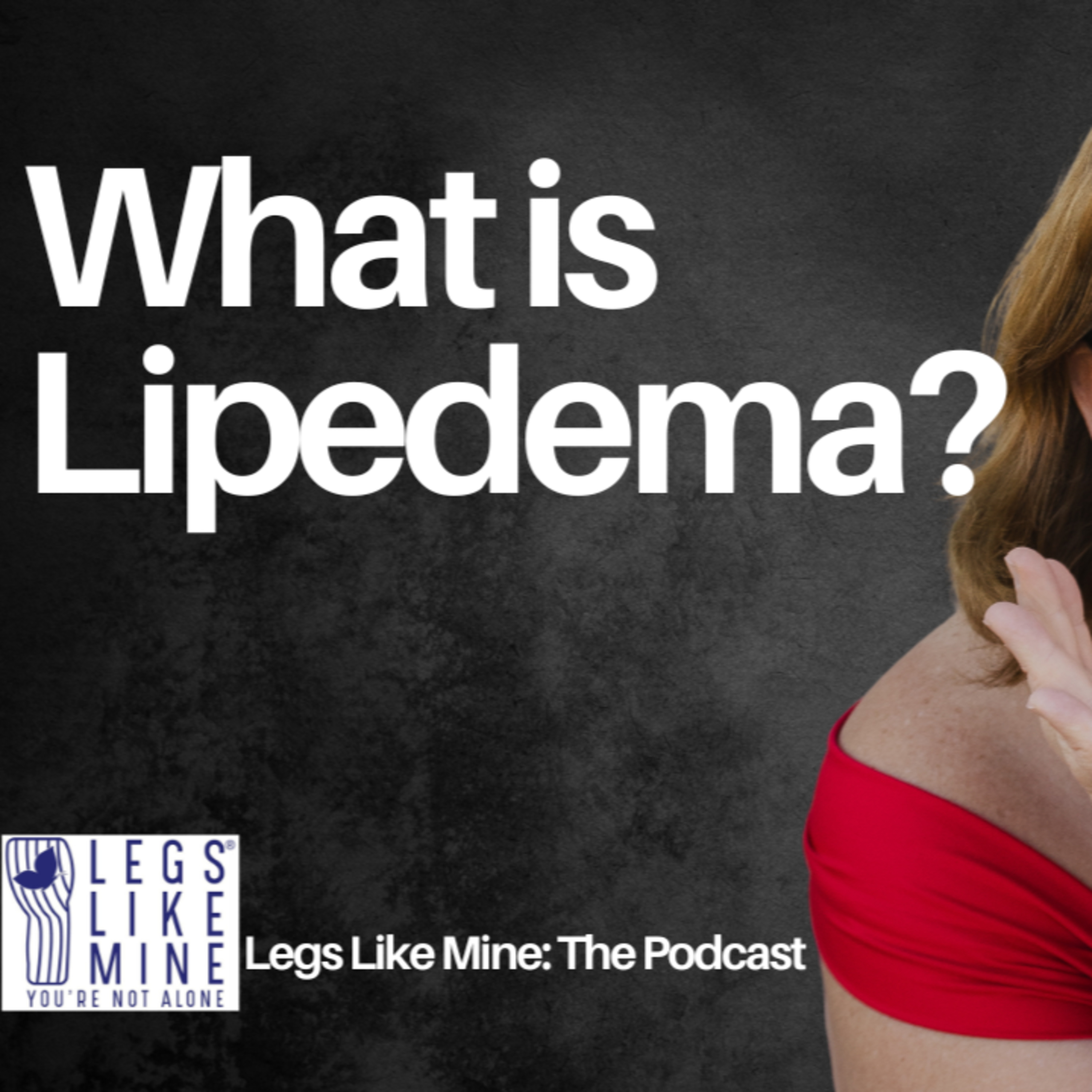 Legs Like Mine: The Podcast Episode 2: Lipedema Explained: Causes, Symptoms, and More episode artwork