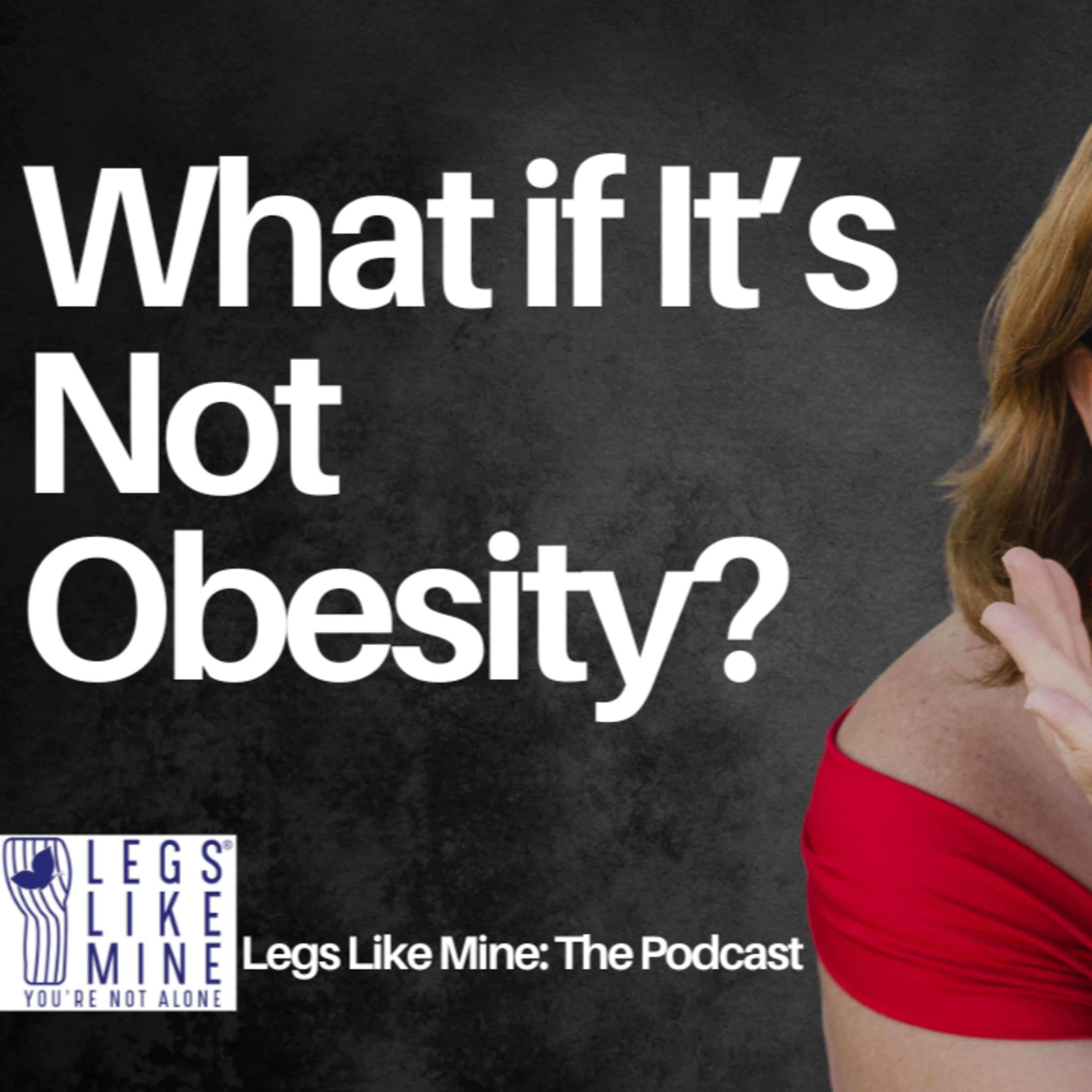 Legs Like Mine: The Podcast Episode 5: How Lipedema Is Different from Obesity What You Need to Know episode artwork