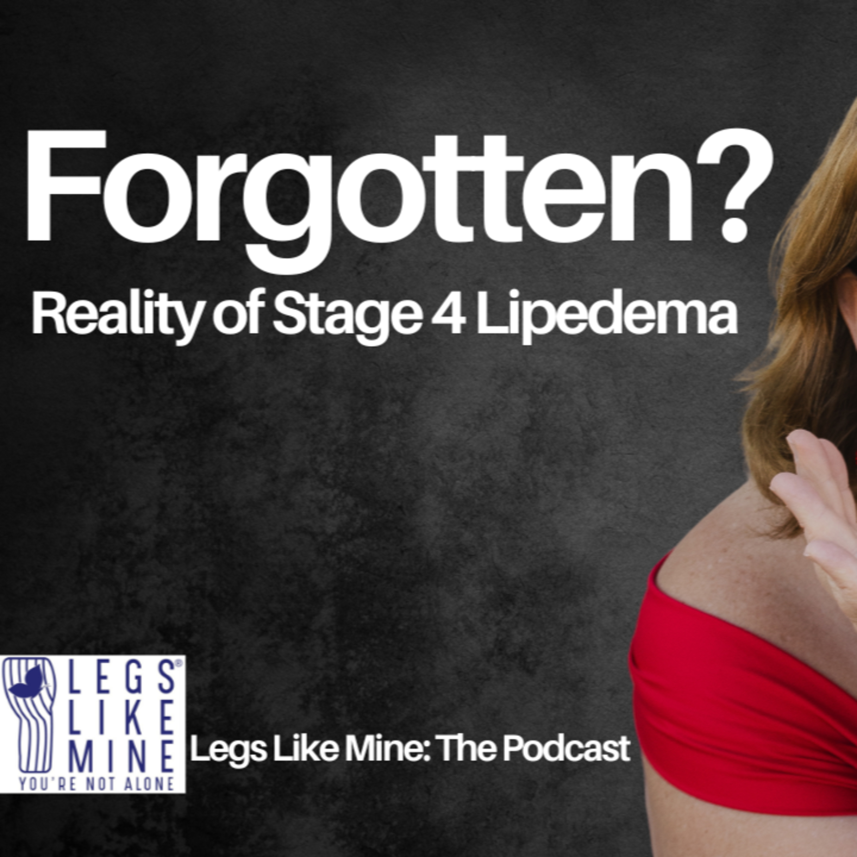 Legs Like Mine: The Podcast Episode 7: Women the Medical System Left Behind Stage 4 Lipedema episode artwork