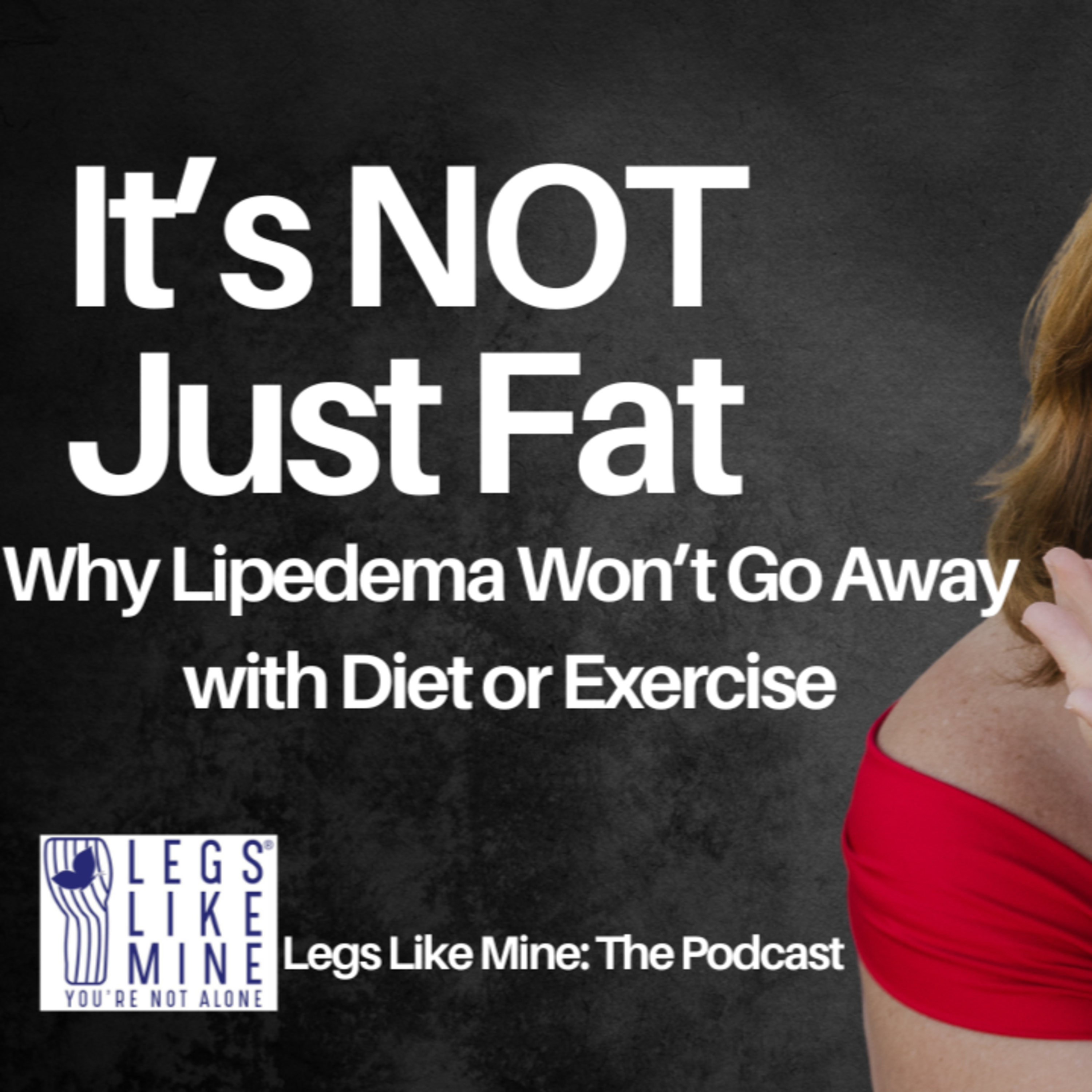 Legs Like Mine: The Podcast Episode 8: Why Diets & Exercise Don't Work for Lipedema, Based on US Std episode artwork