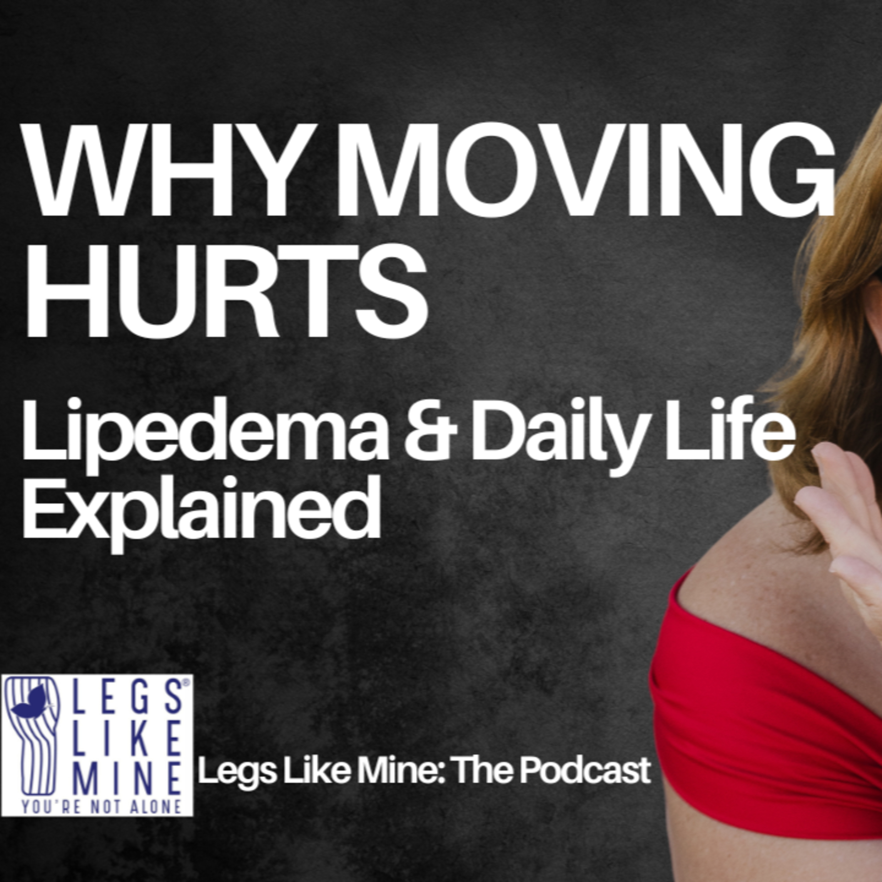 Legs Like Mine: The Podcast Episode 15: Lipedema & Mobility-Why Everyday Life Hurts episode artwork