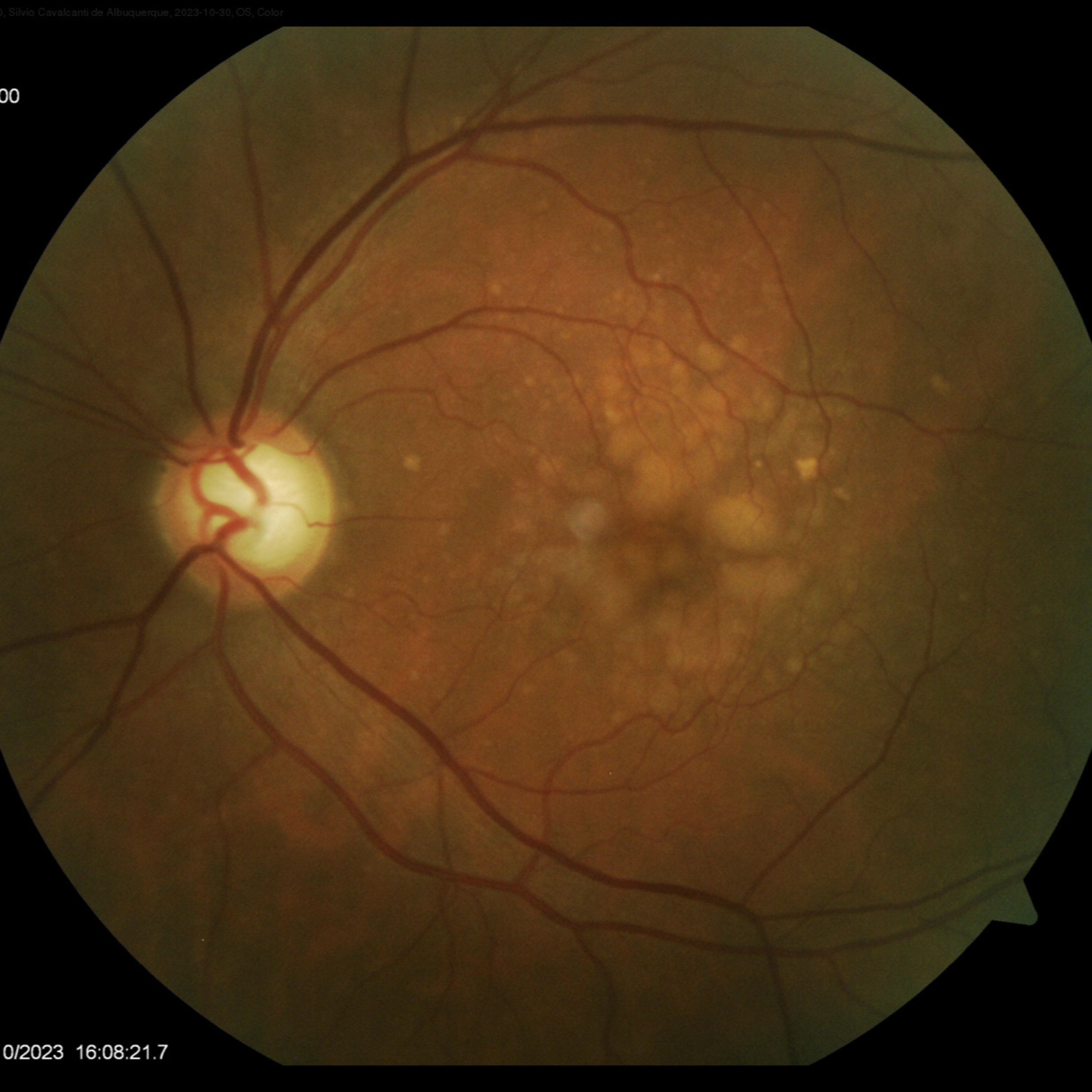 Retina e Oftalmo Podcast