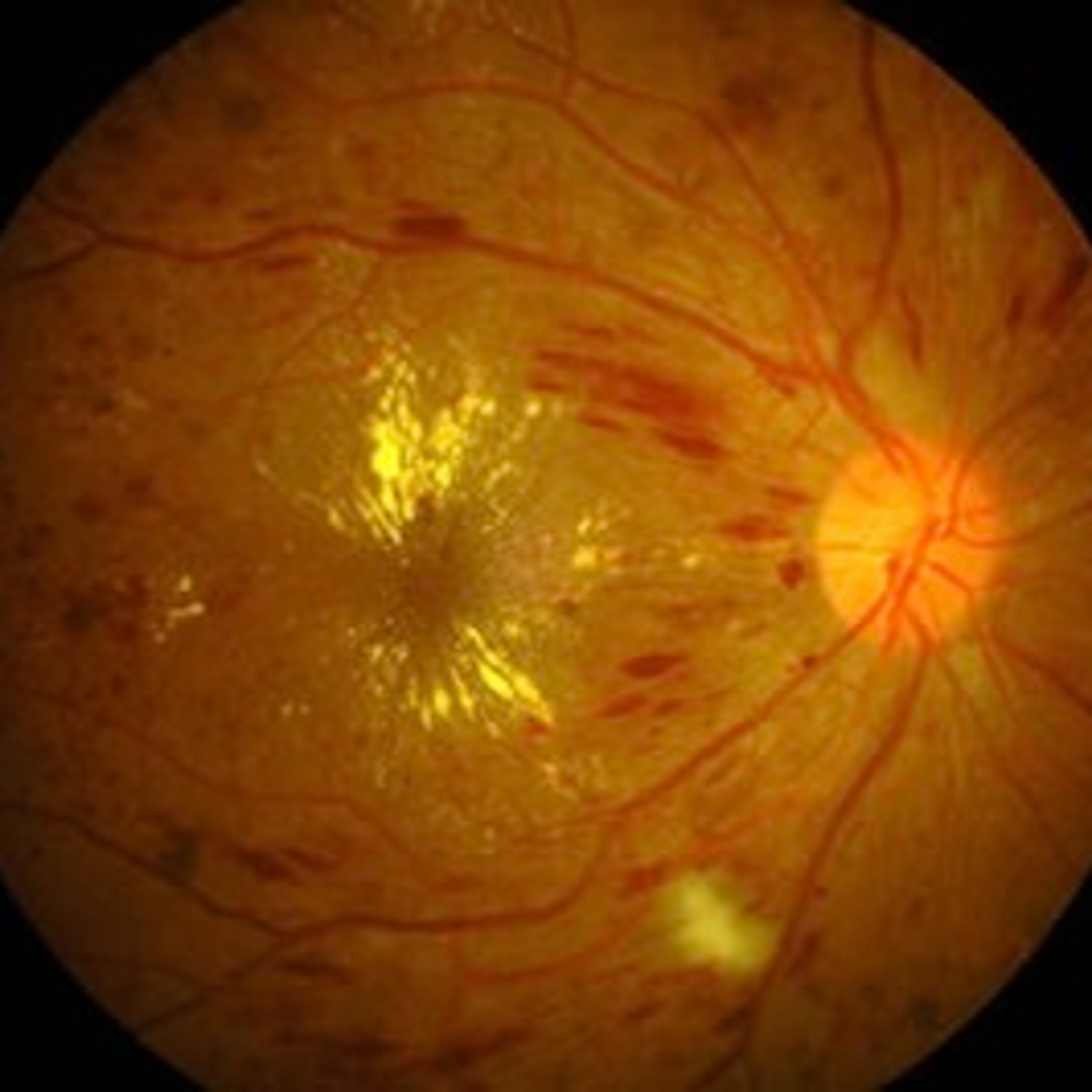 Retina e Oftalmo Podcast