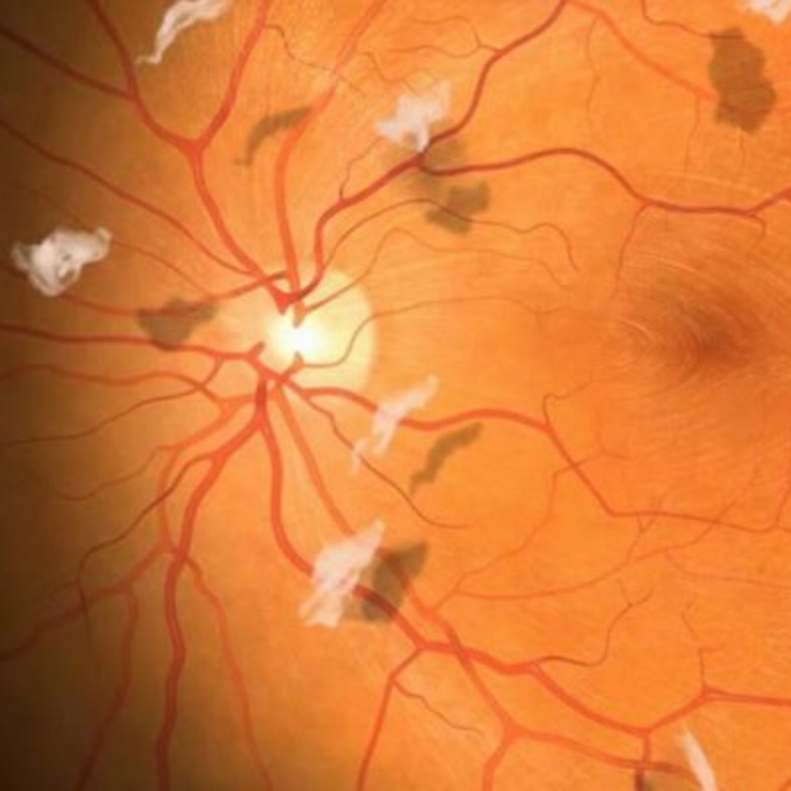 Retina e Oftalmo Podcast