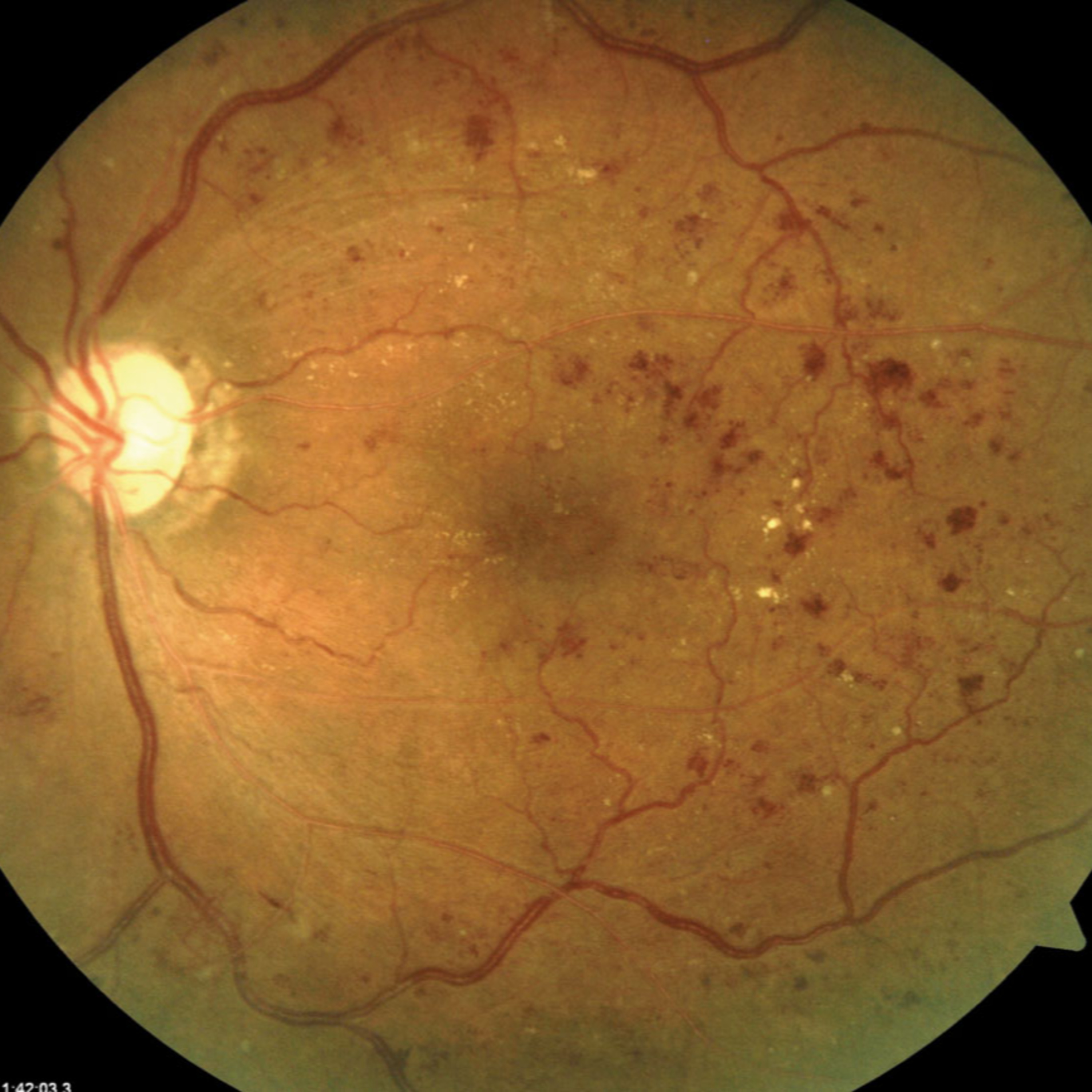 Retina e Oftalmo Podcast
