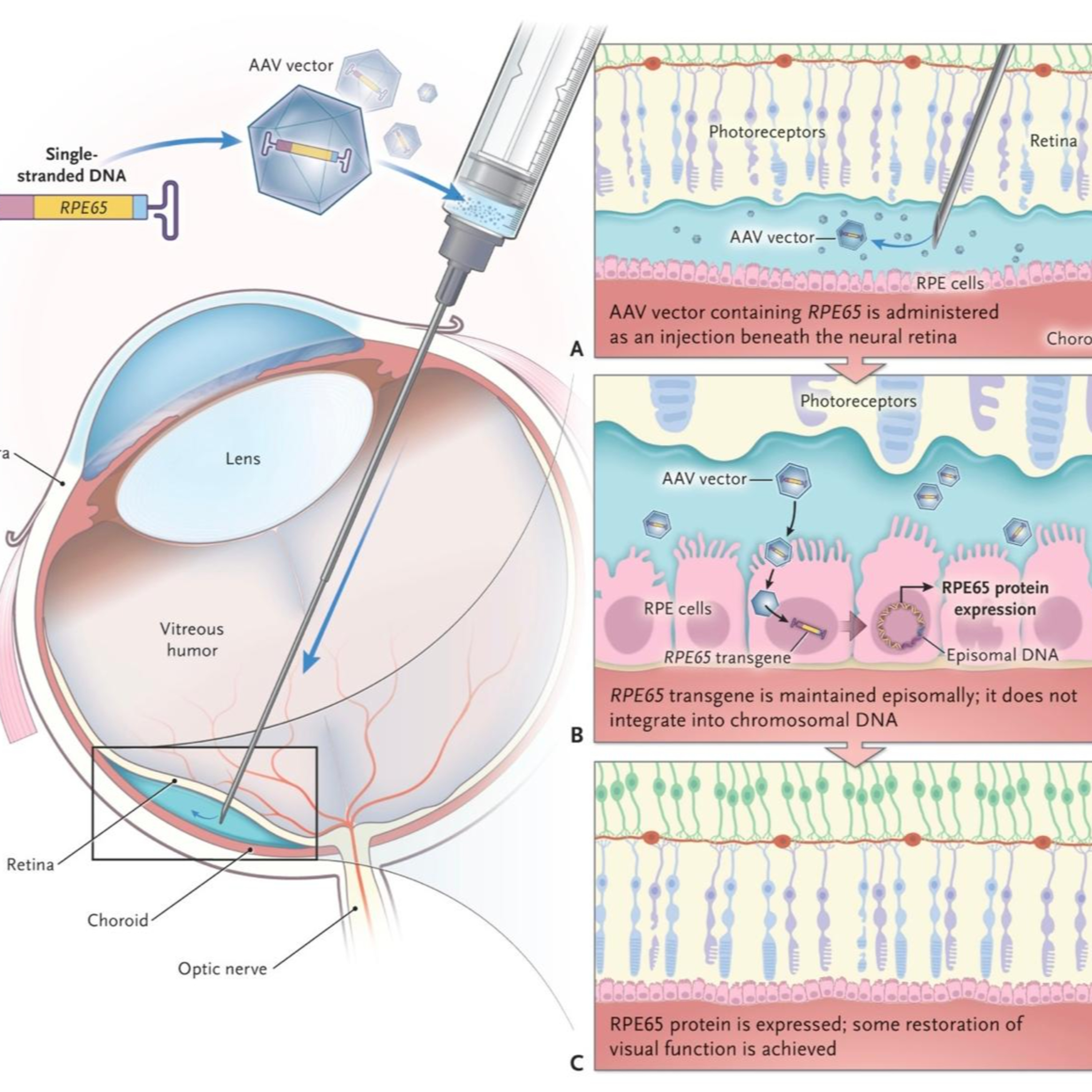 Retina e Oftalmo Podcast