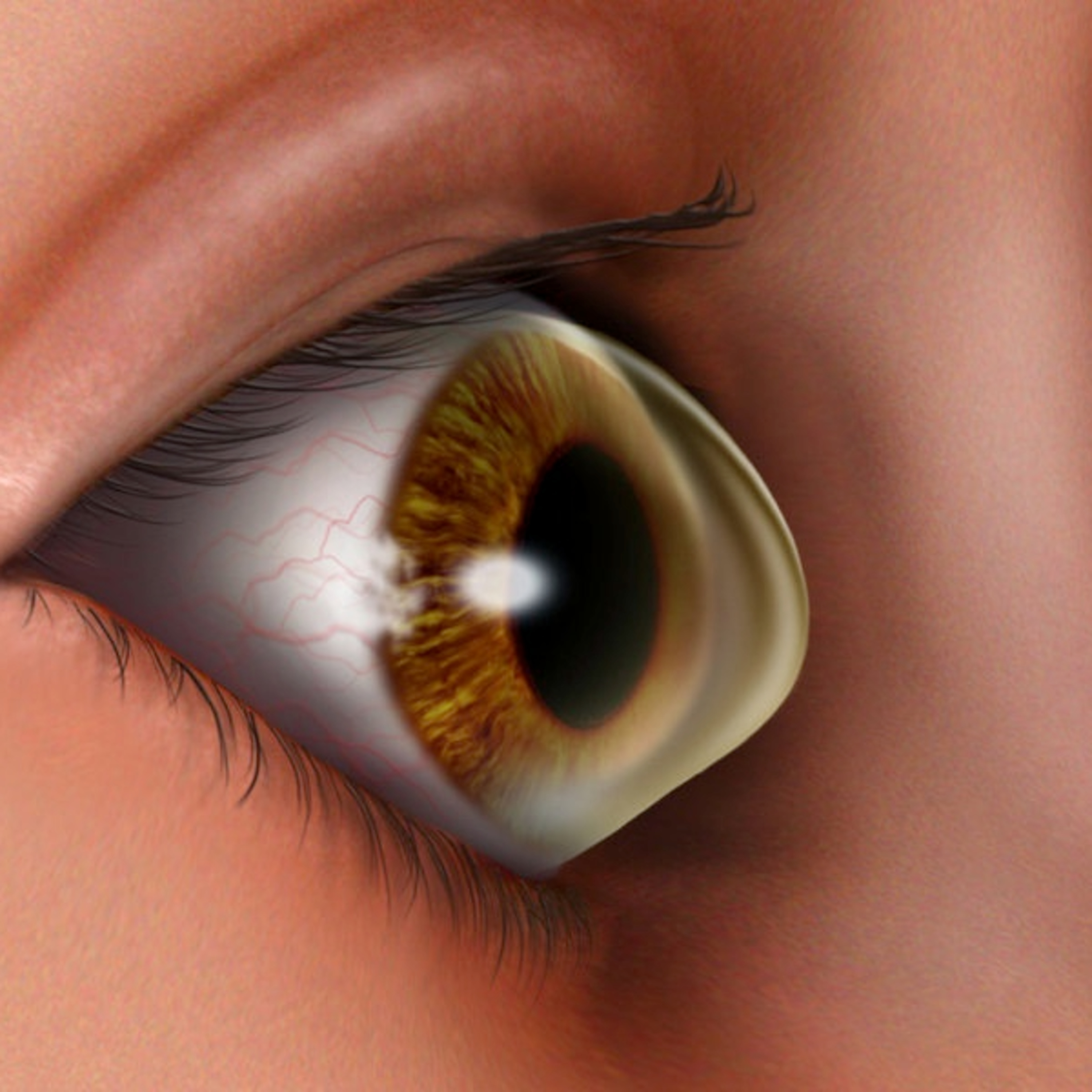 Retina e Oftalmo Podcast