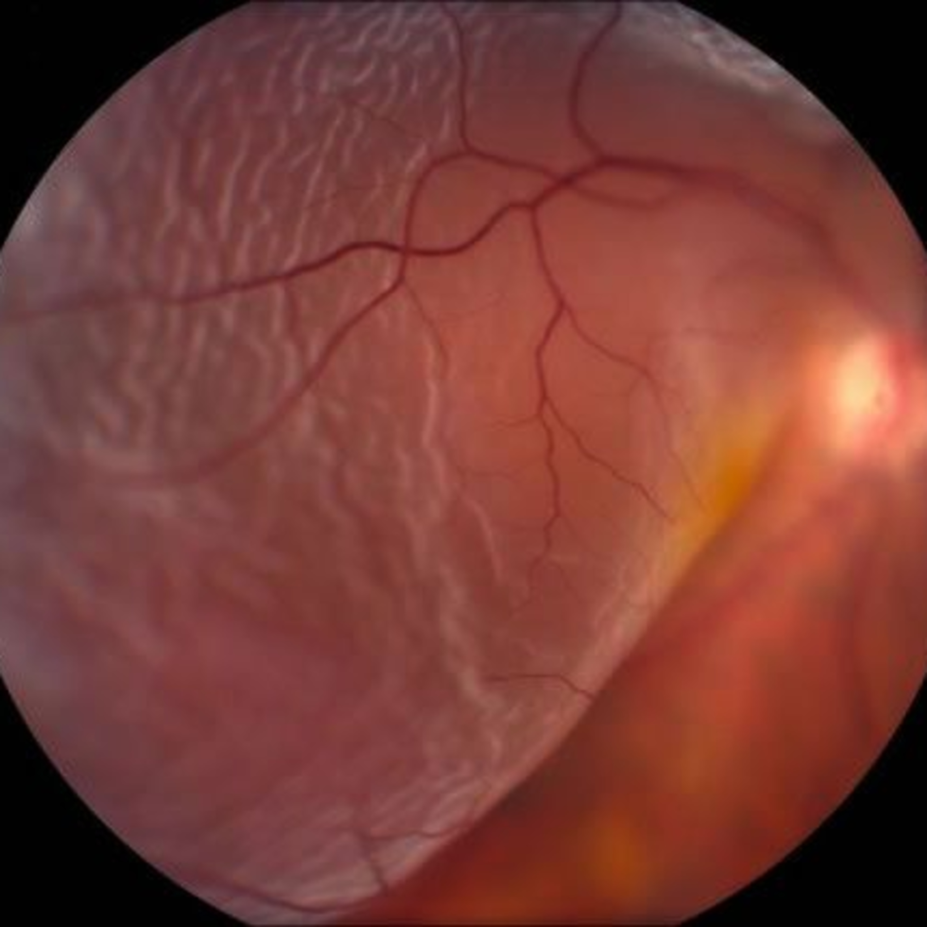 Retina e Oftalmo Podcast