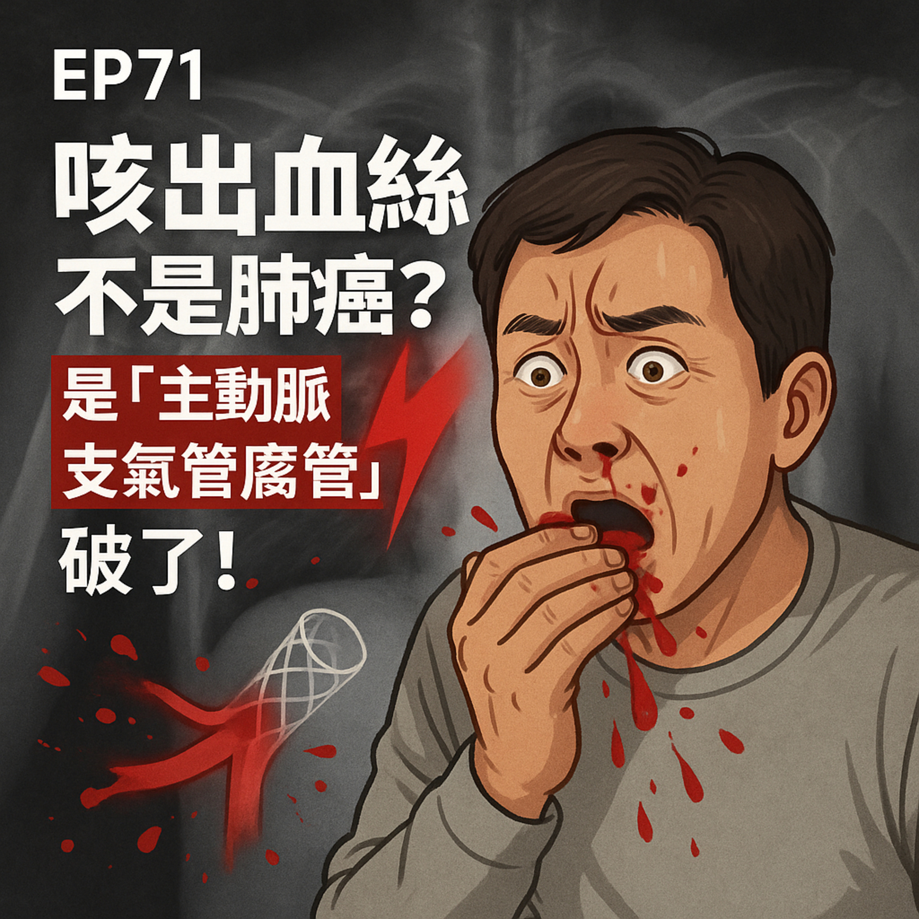 🎙️EP71｜咳血不是肺癌？小心「主動脈支氣管廔管」爆血送命！