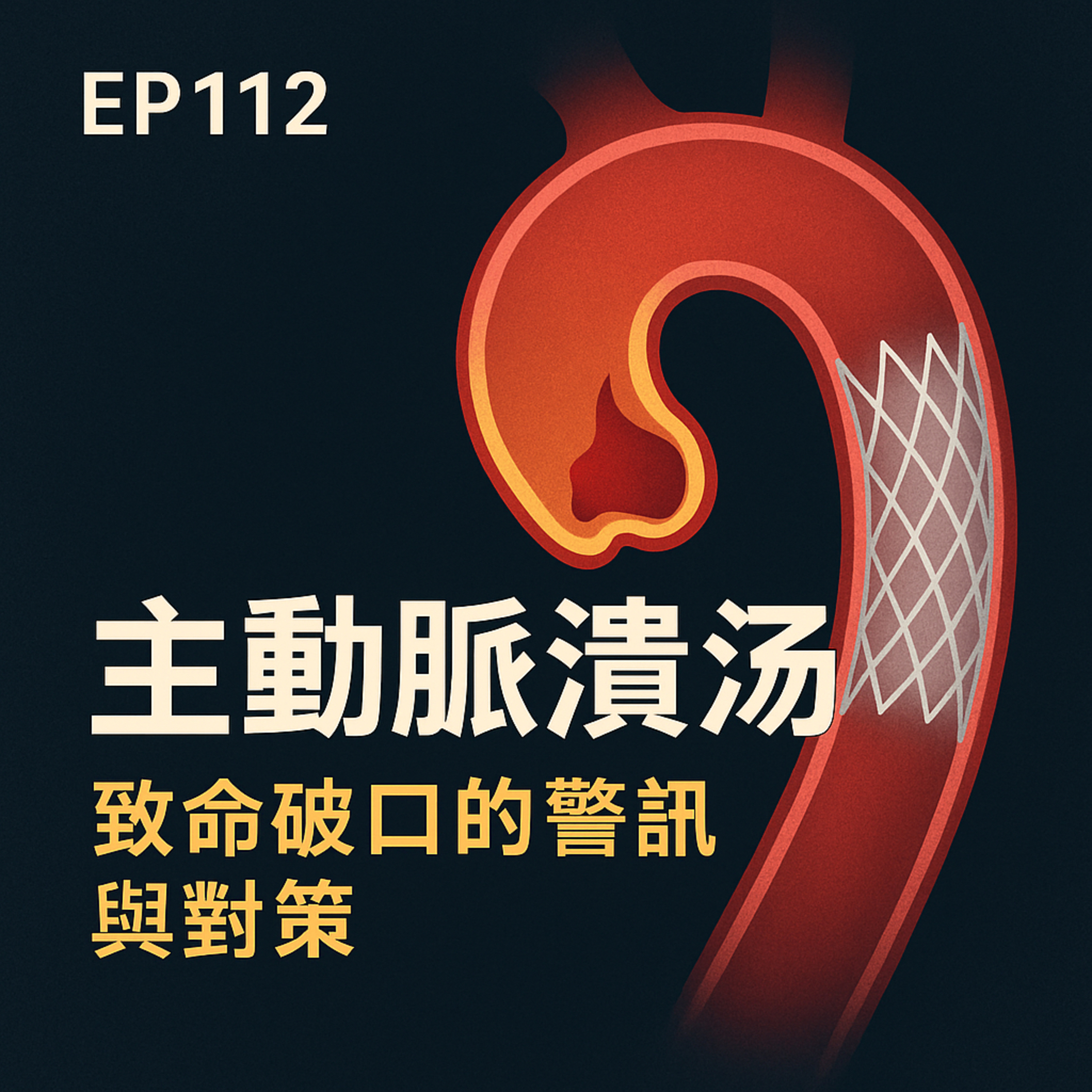 🎙️EP112｜不是剝離也不是動脈瘤？主動脈潰瘍：致命破口的警訊與對策