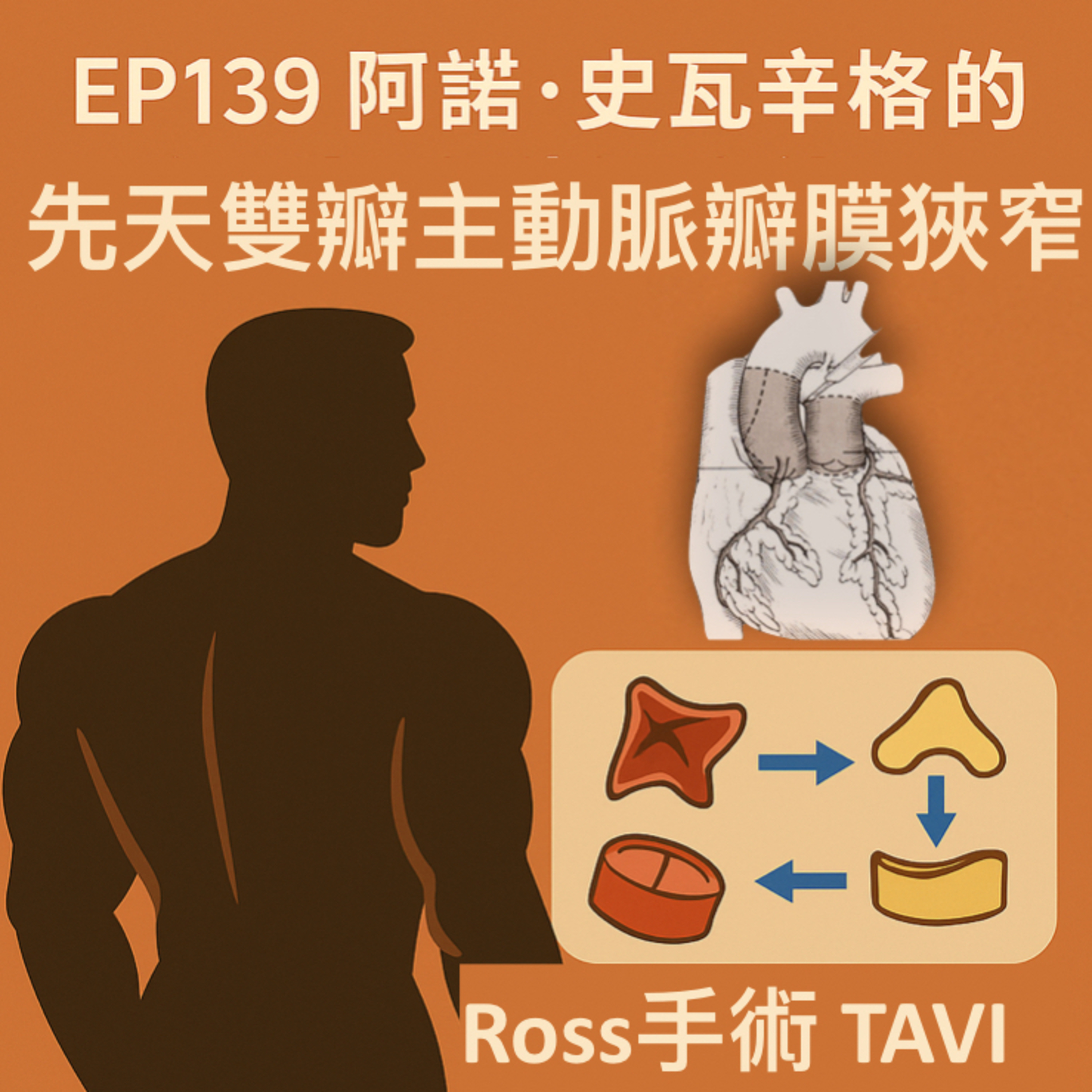 🎙️EP139｜鋼鐵阿諾的心臟也需要修復？一位動作巨星與先天主動脈瓣缺陷的手術之路