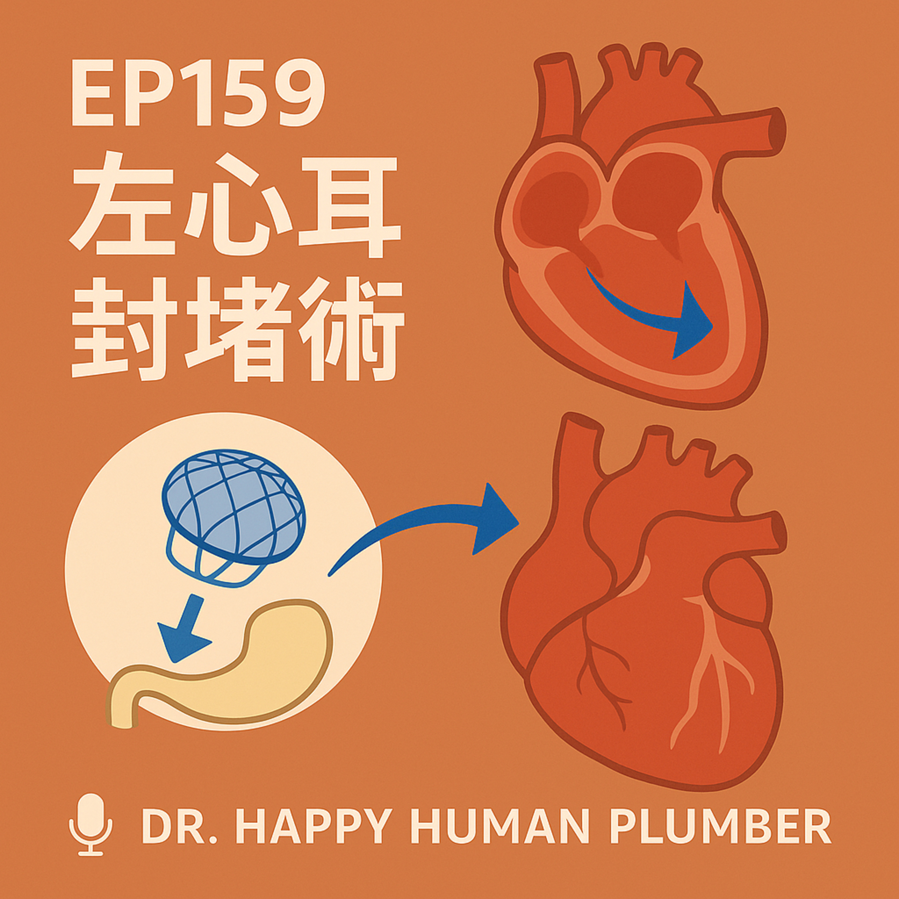 🎙️EP159｜左心耳封堵術（LAAO）：預防中風的新選擇
